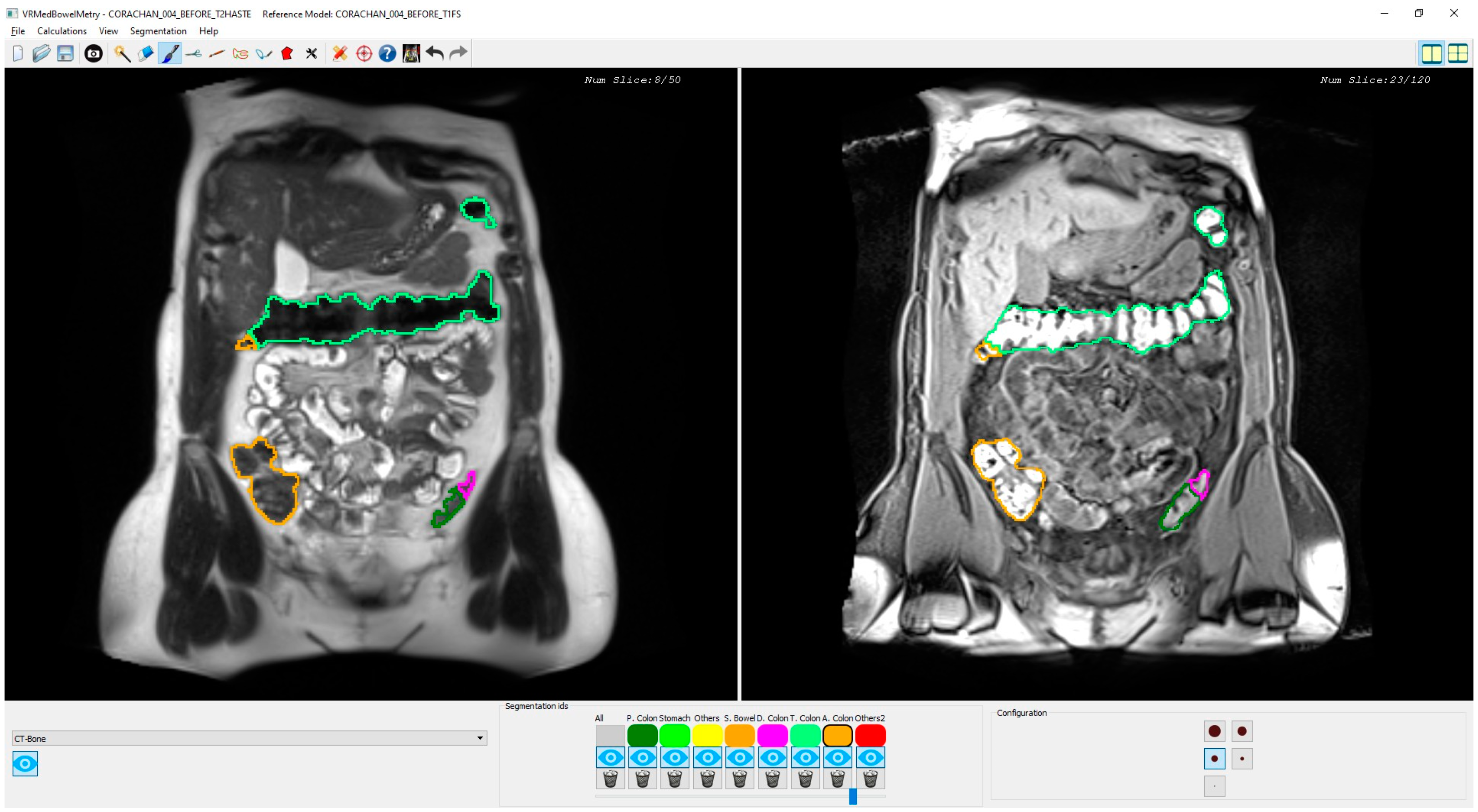 Diagnostics 13 00910 g003 Diagnostics 13 00910 g003