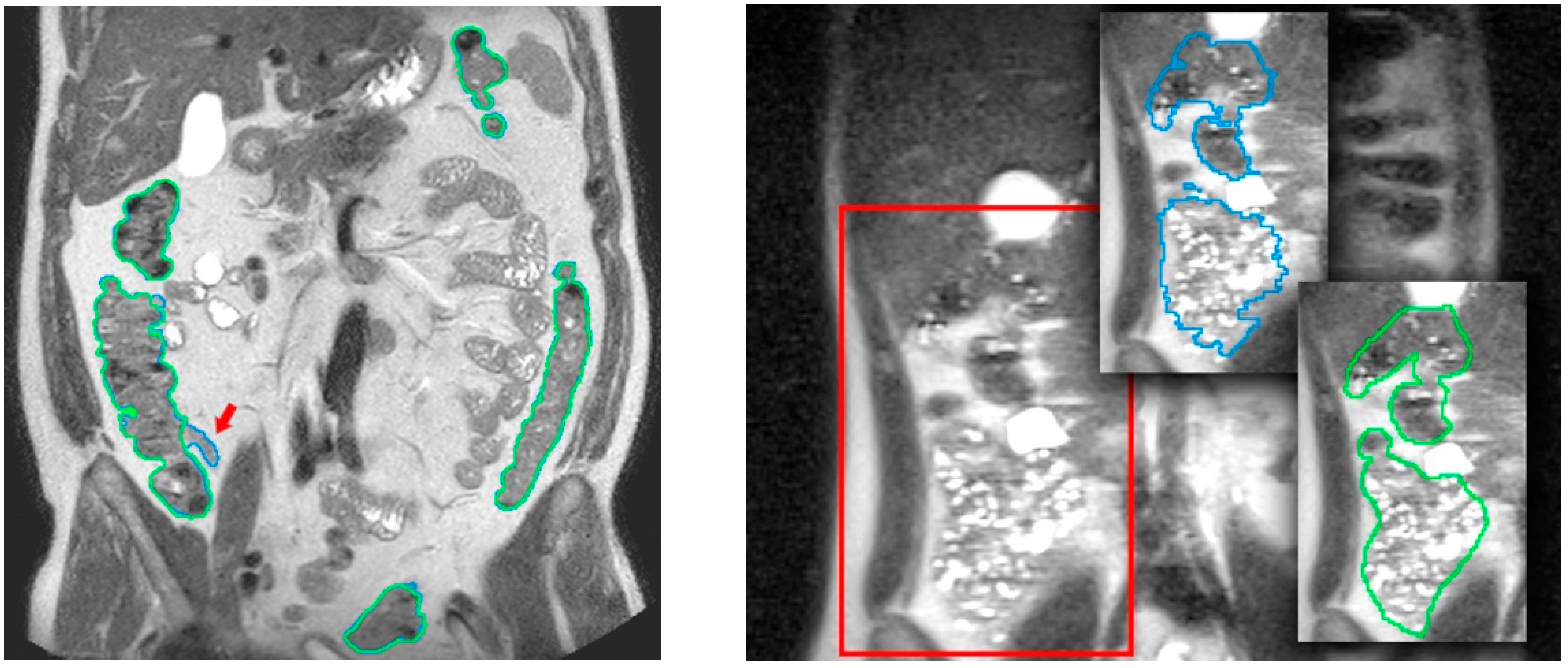 Diagnostics 13 00910 g004 Diagnostics 13 00910 g004