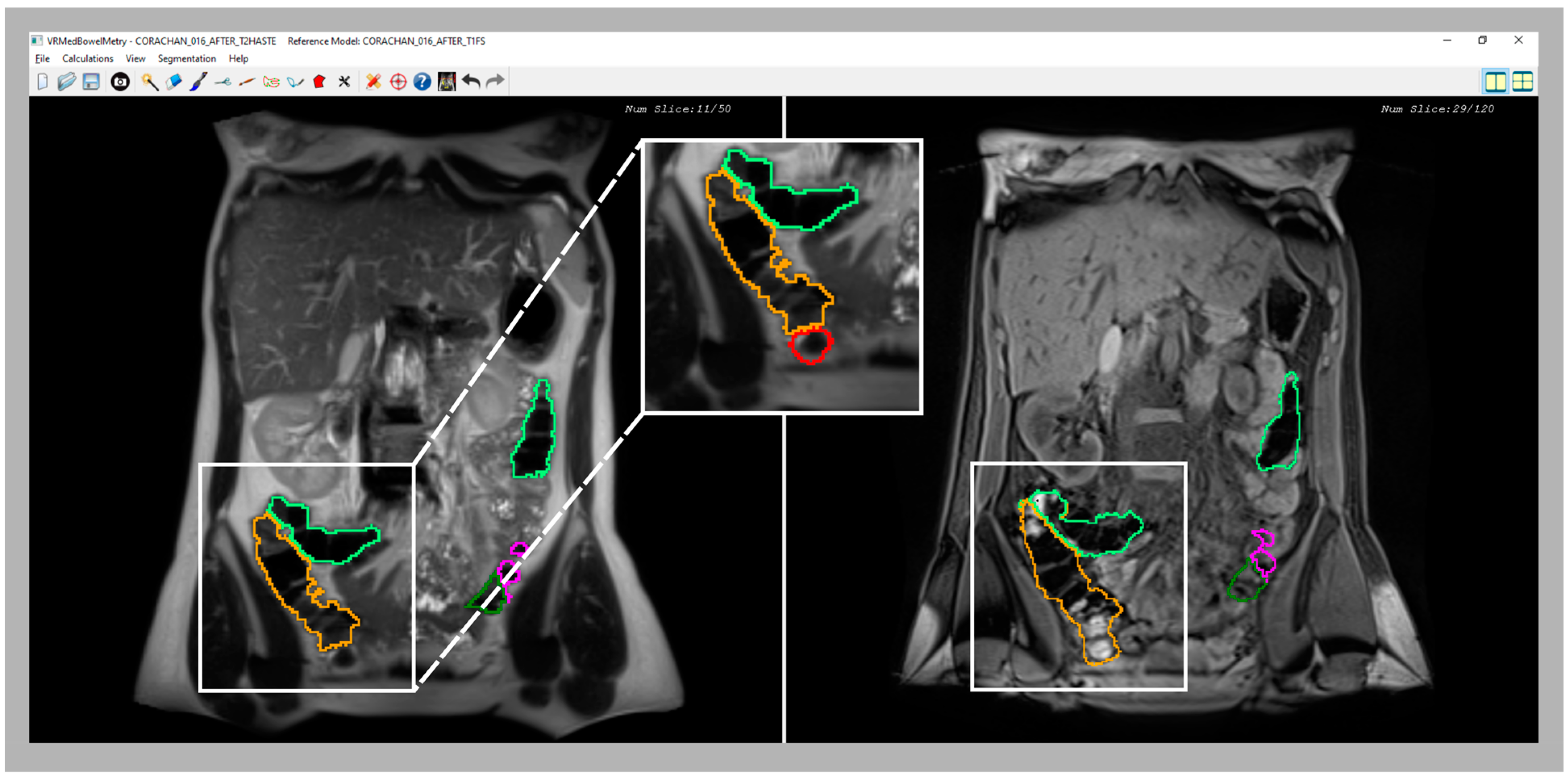 Diagnostics 13 00910 g006 Diagnostics 13 00910 g006