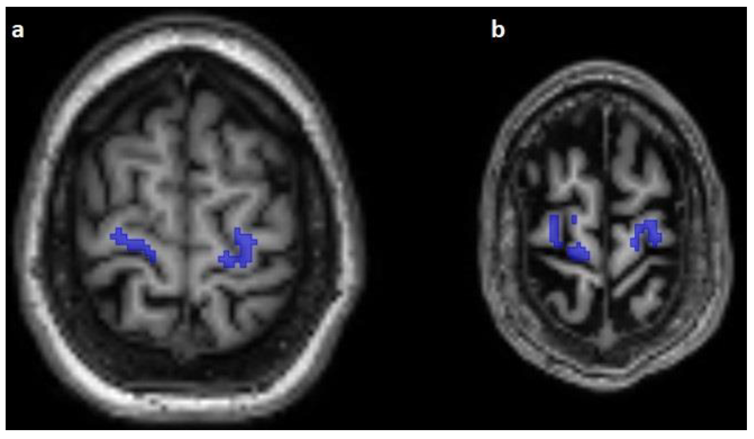 Diagnostics 13 00911 g003