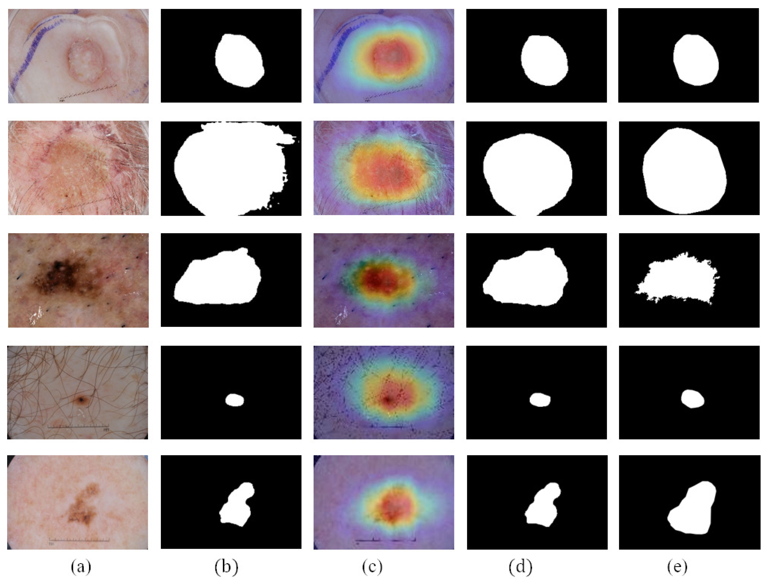 Diagnostics 13 00912 g005