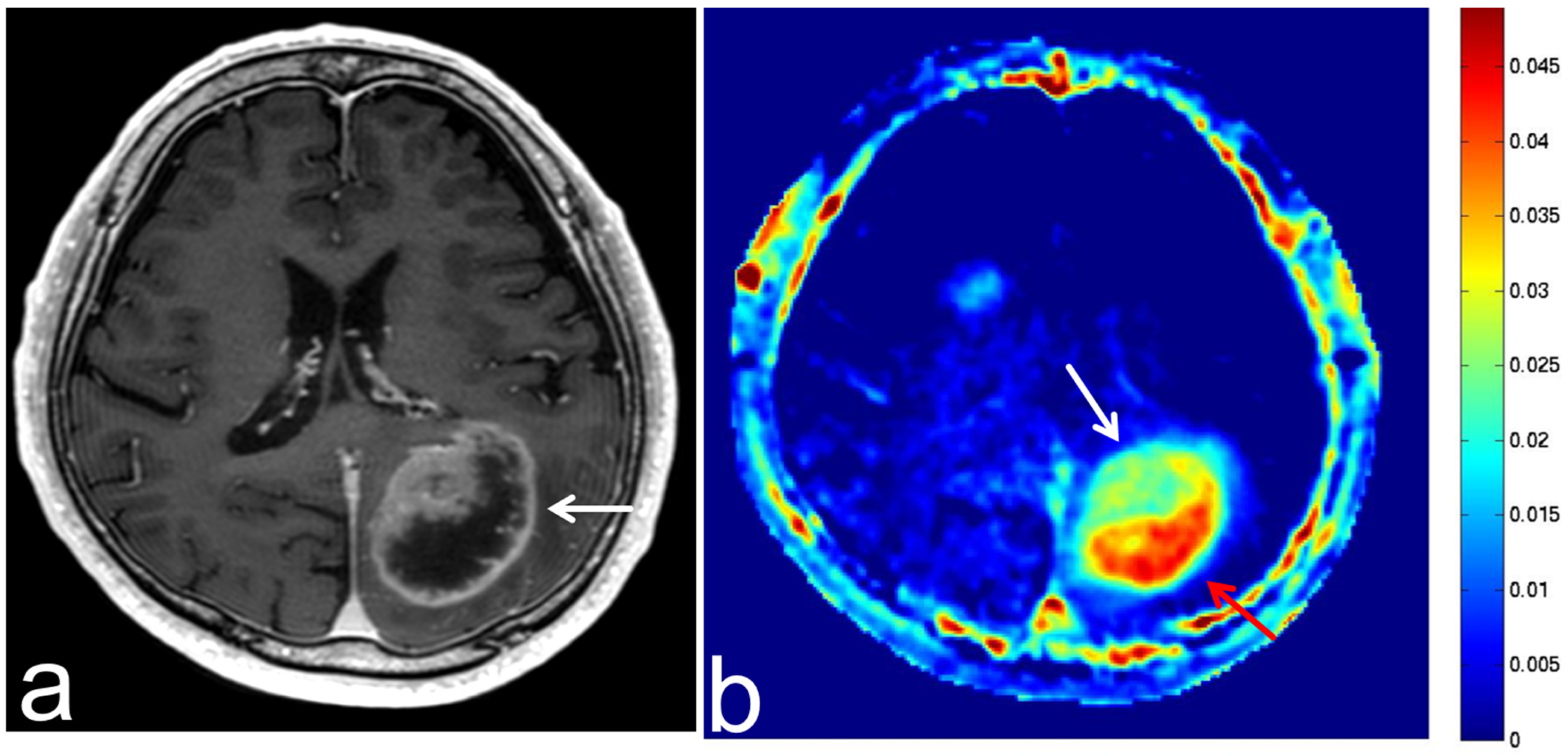 Diagnostics 13 00914 g004