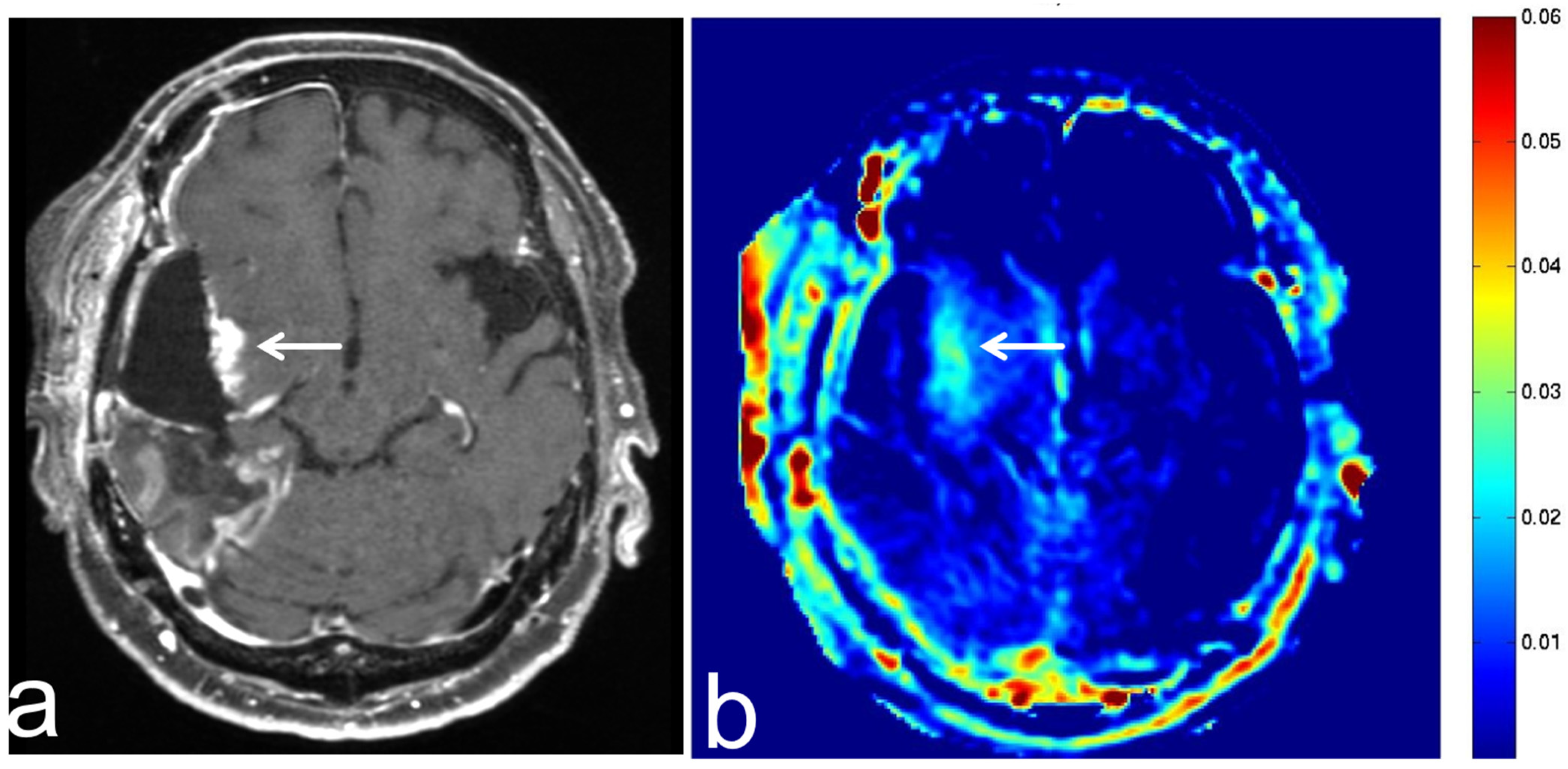 Diagnostics 13 00914 g005