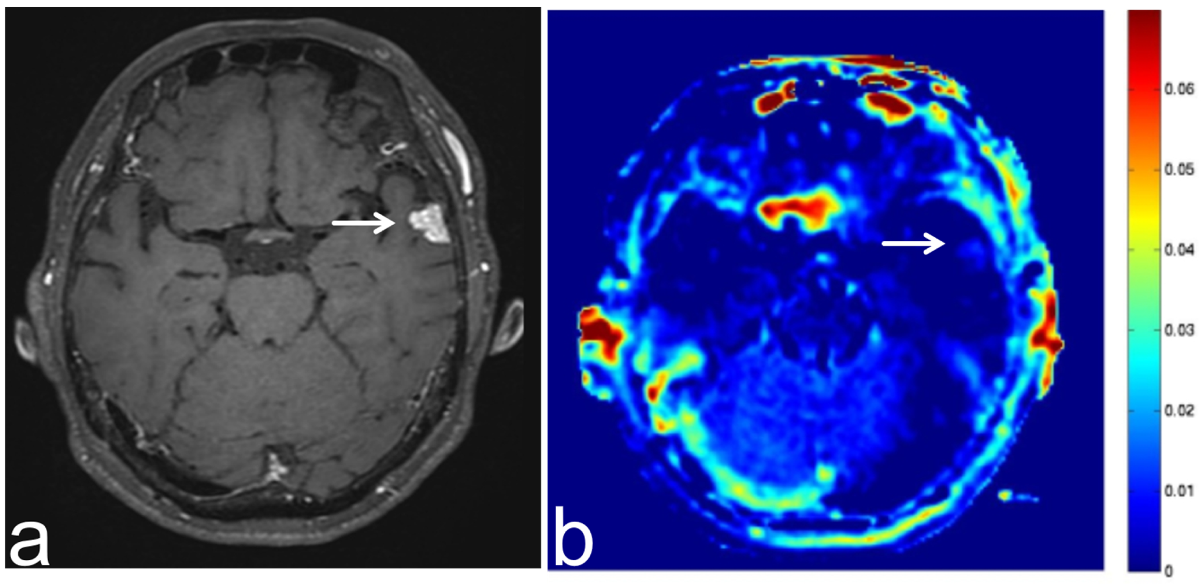 Diagnostics 13 00914 g009