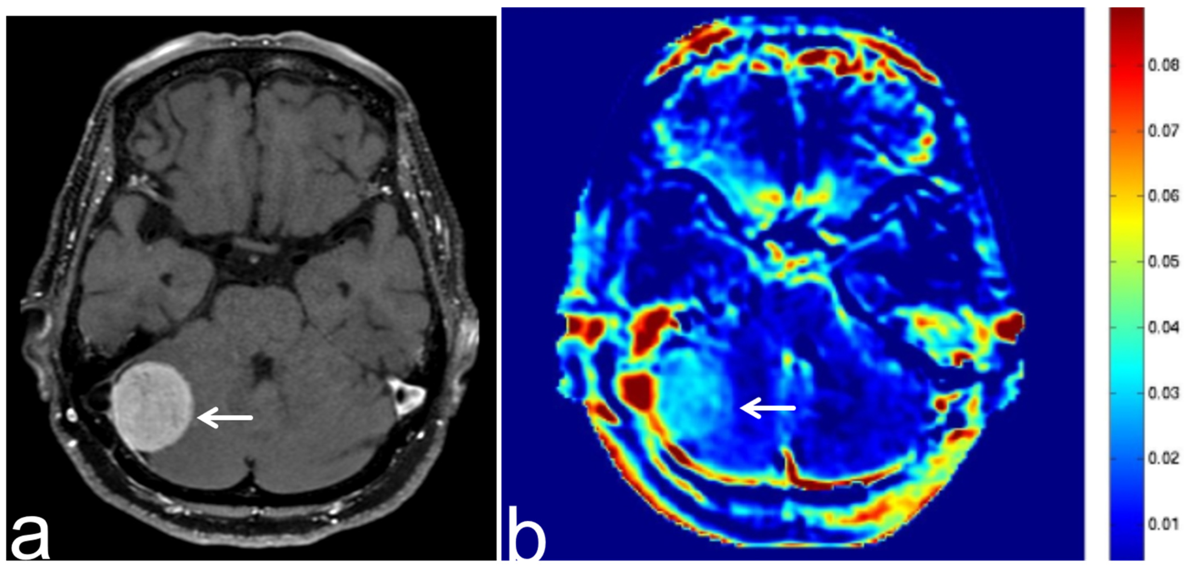 Diagnostics 13 00914 g010