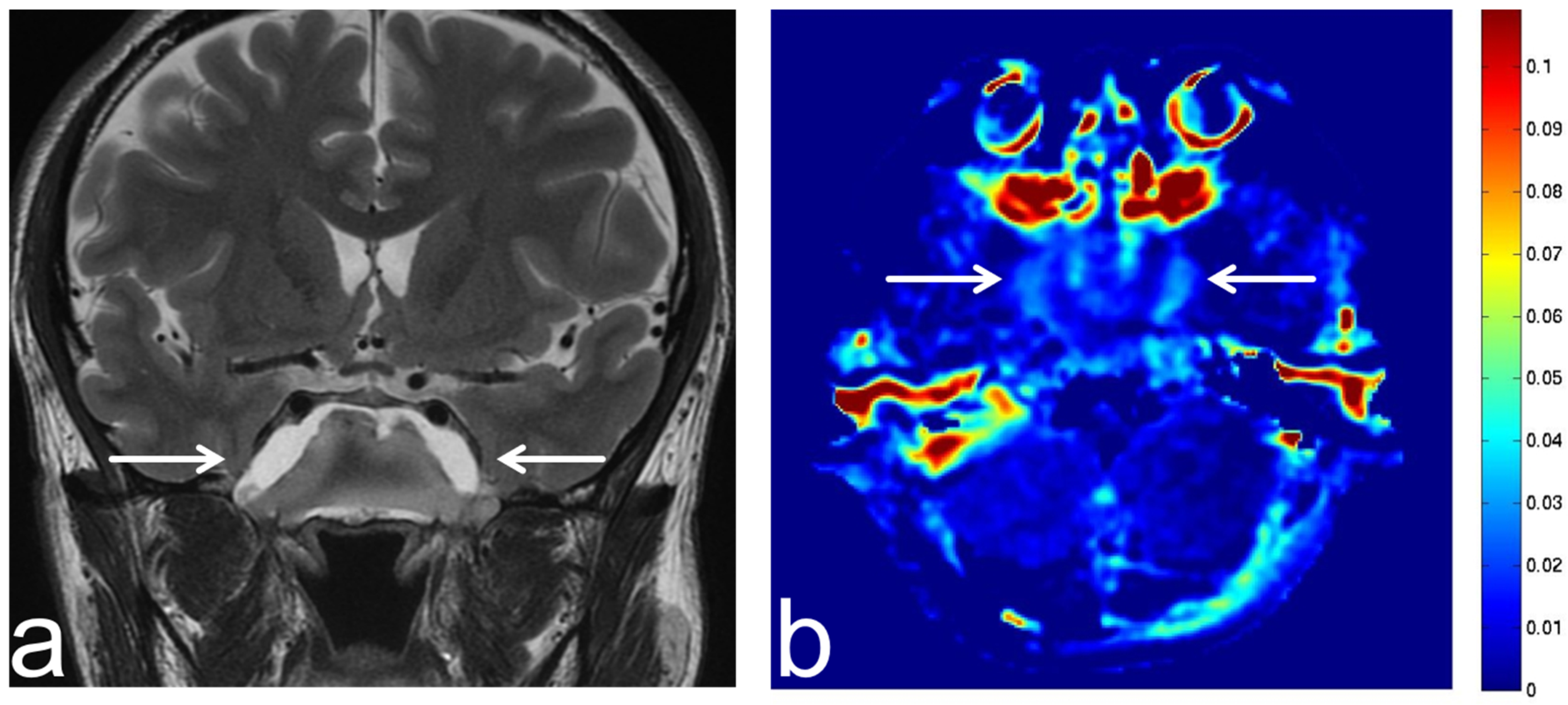 Diagnostics 13 00914 g012