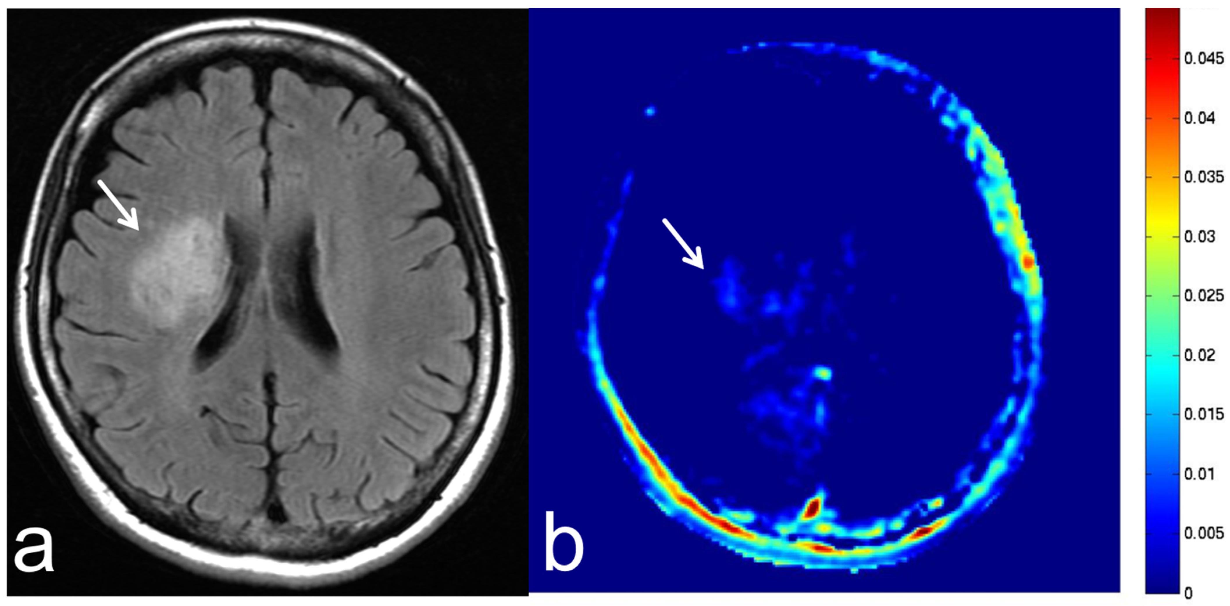 Diagnostics 13 00914 g020