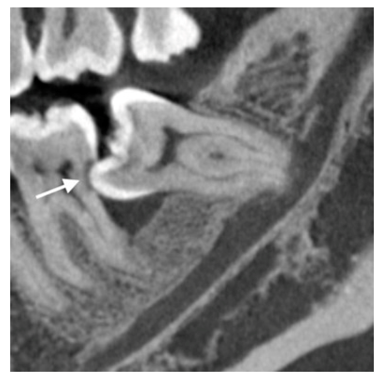 Diagnostics 13 00919 g003