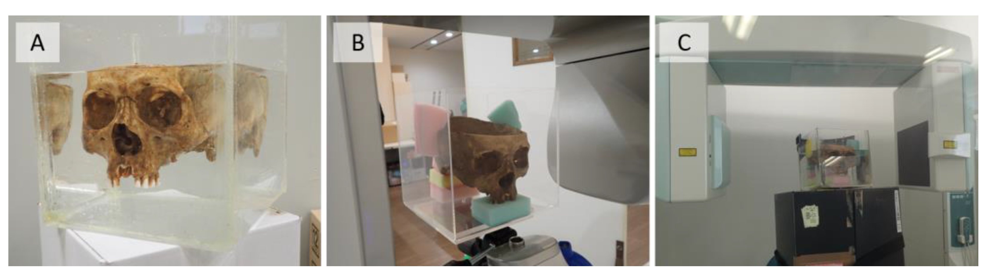 Diagnostics 13 00921 g001