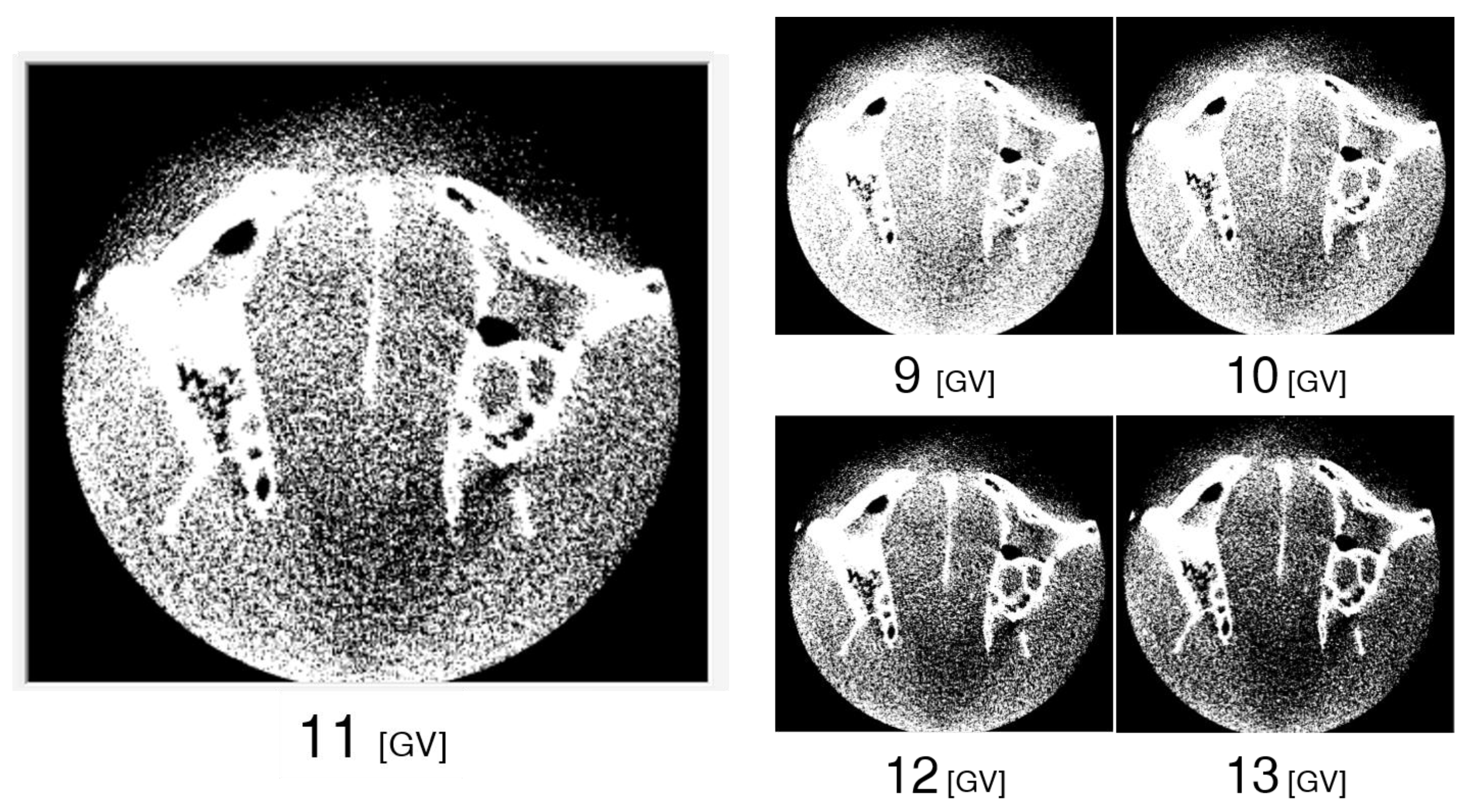 Diagnostics 13 00921 g005