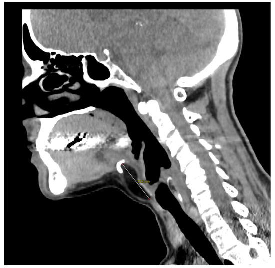 Diagnostics 13 00932 g002