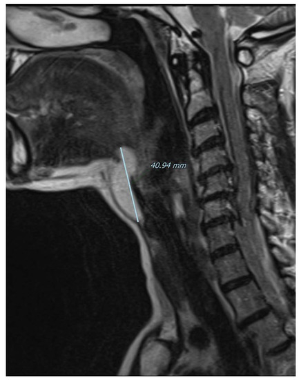 Diagnostics 13 00932 g003