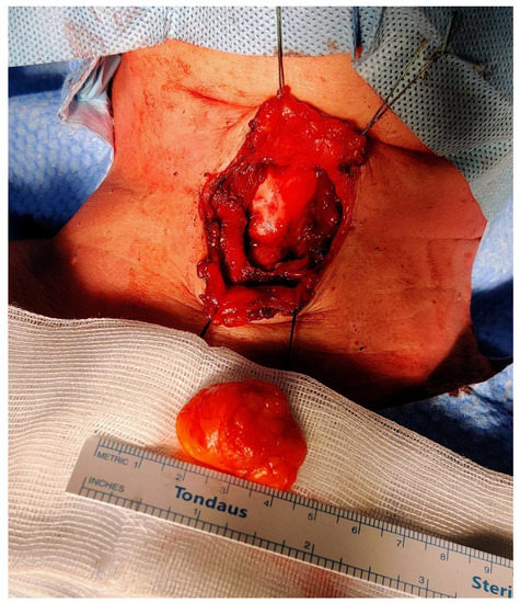 Diagnostics 13 00932 g005