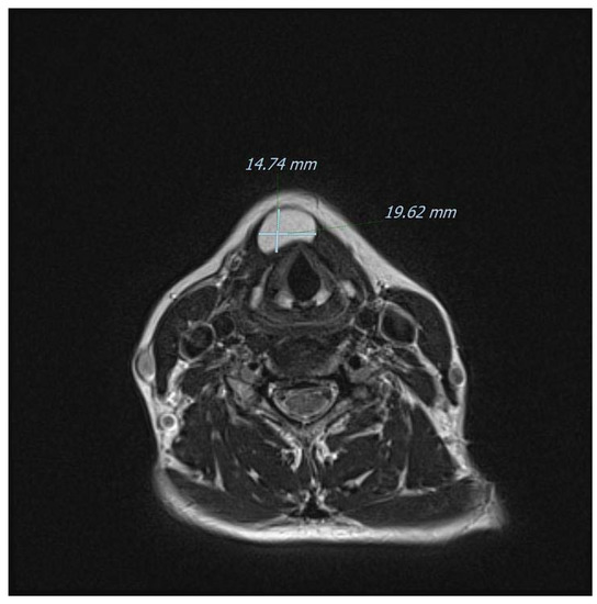 Diagnostics 13 00932 g006
