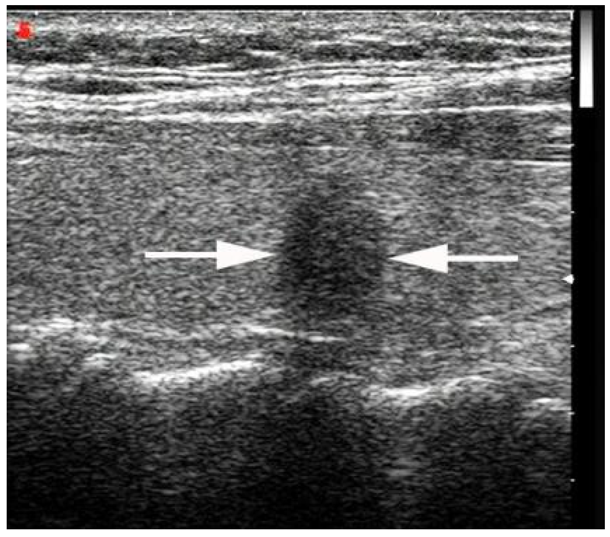 Diagnostics 13 00949 g001 Diagnostics 13 00949 g001