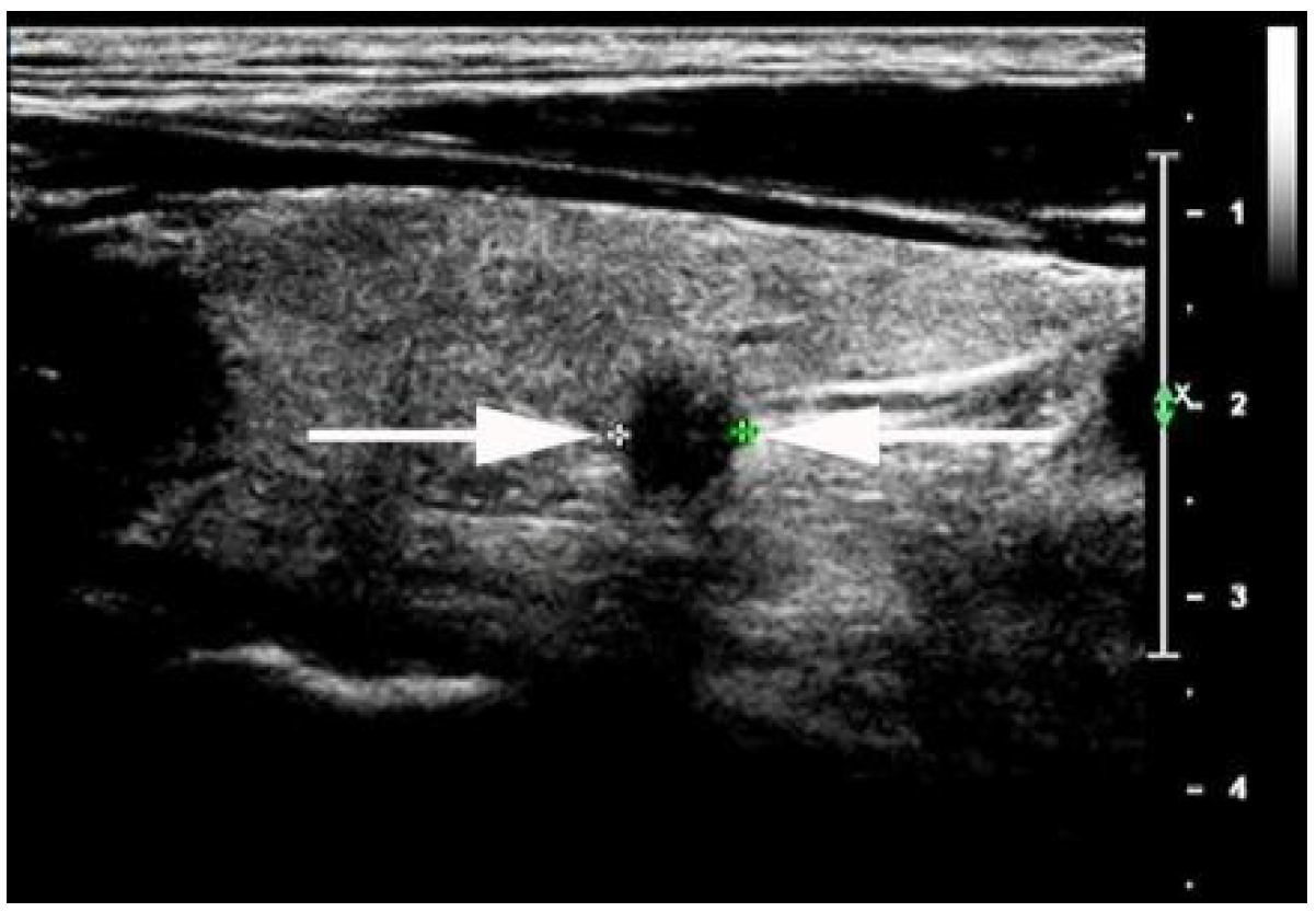 Diagnostics 13 00949 g003 Diagnostics 13 00949 g003