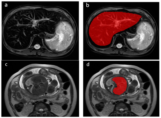 Diagnostics 13 00958 g0a1