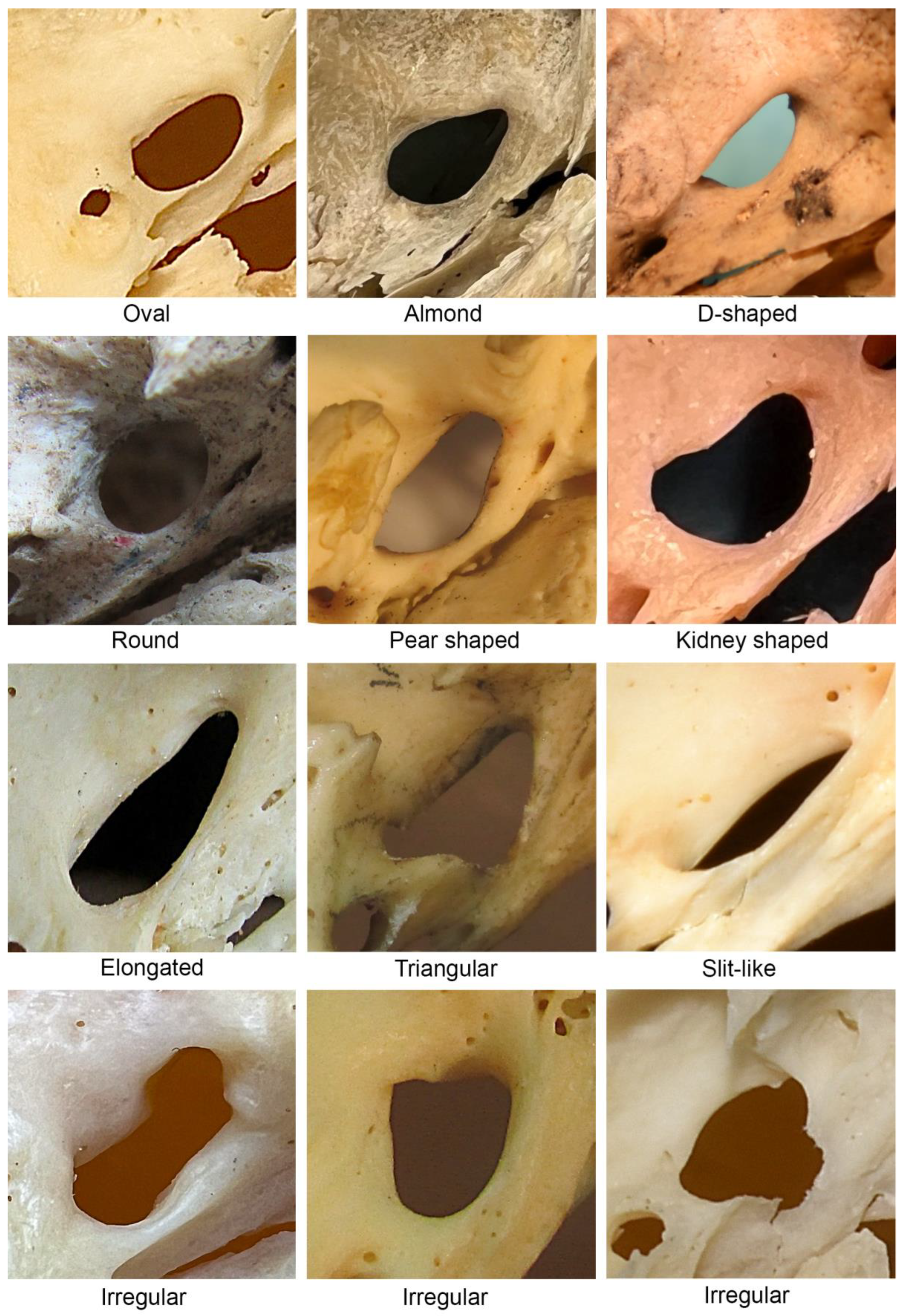 Diagnostics 13 00962 g001 Diagnostics 13 00962 g001