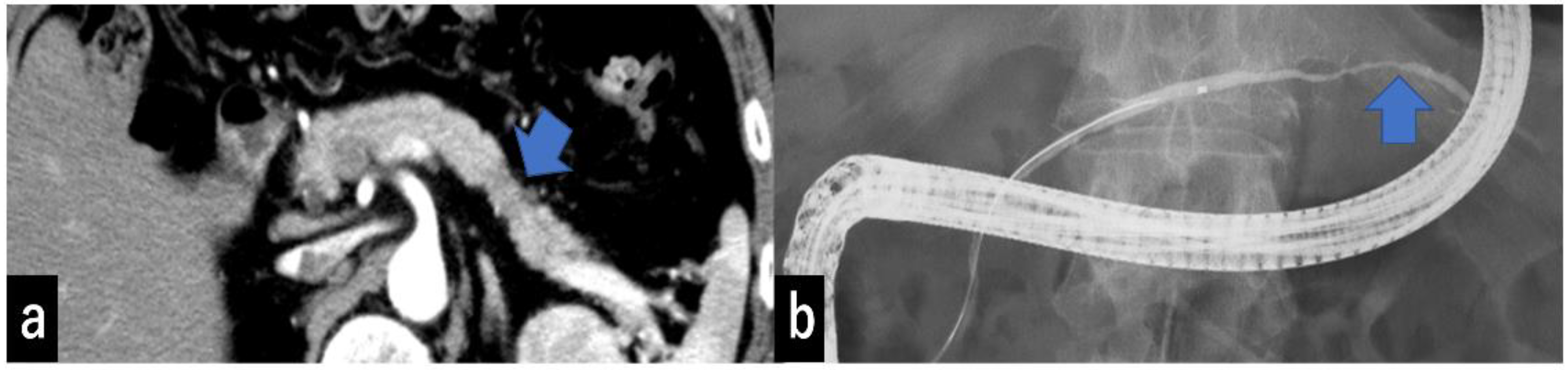 Diagnostics 13 00963 g004 Diagnostics 13 00963 g004