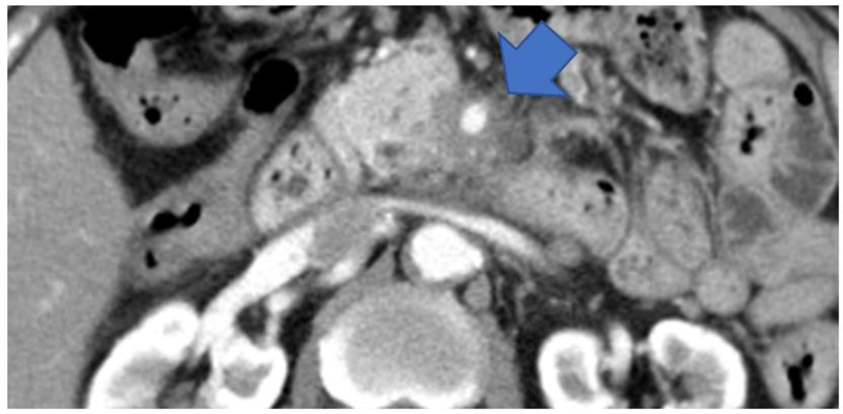 Diagnostics 13 00963 g005 Diagnostics 13 00963 g005