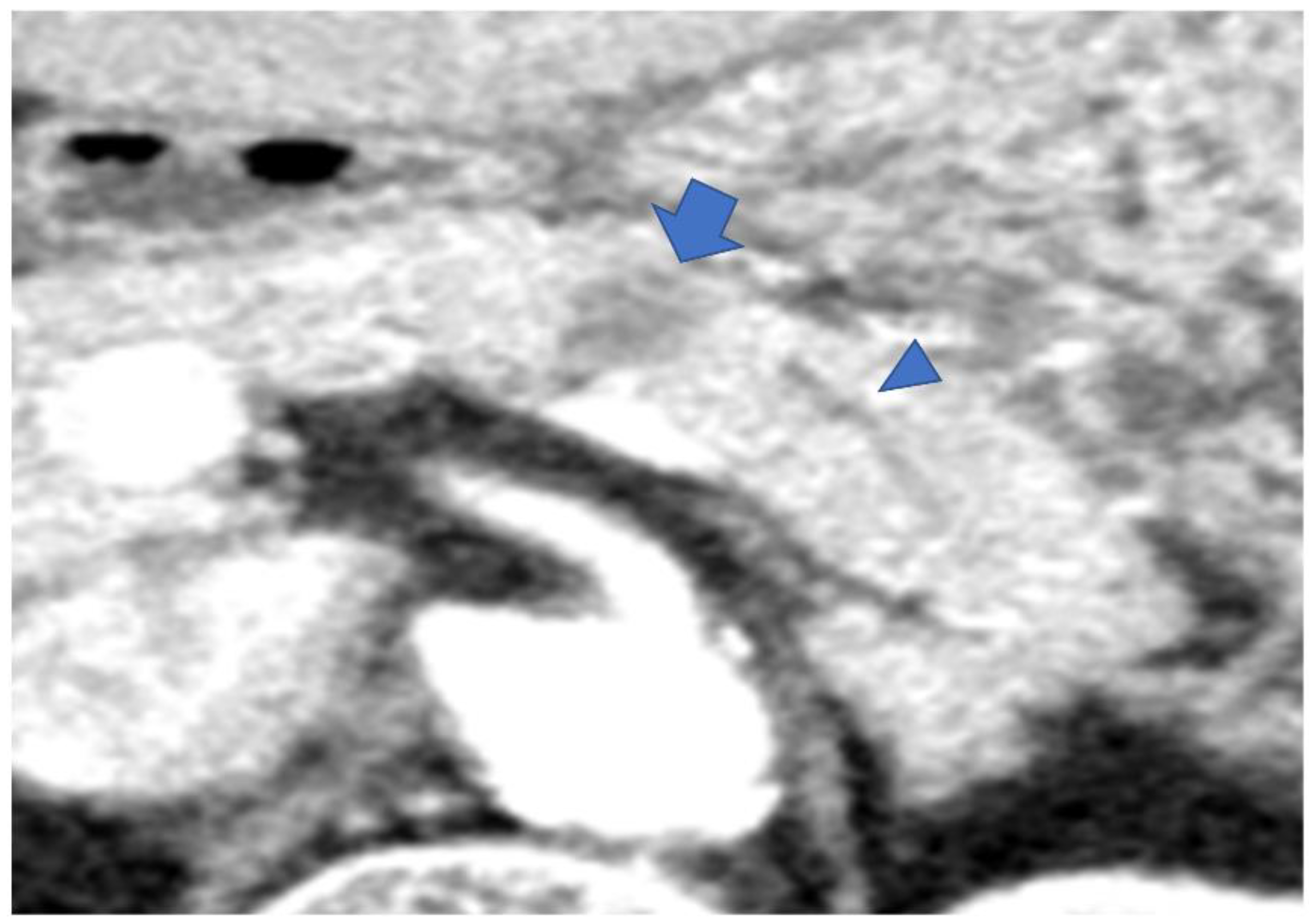 Diagnostics 13 00963 g007 Diagnostics 13 00963 g007