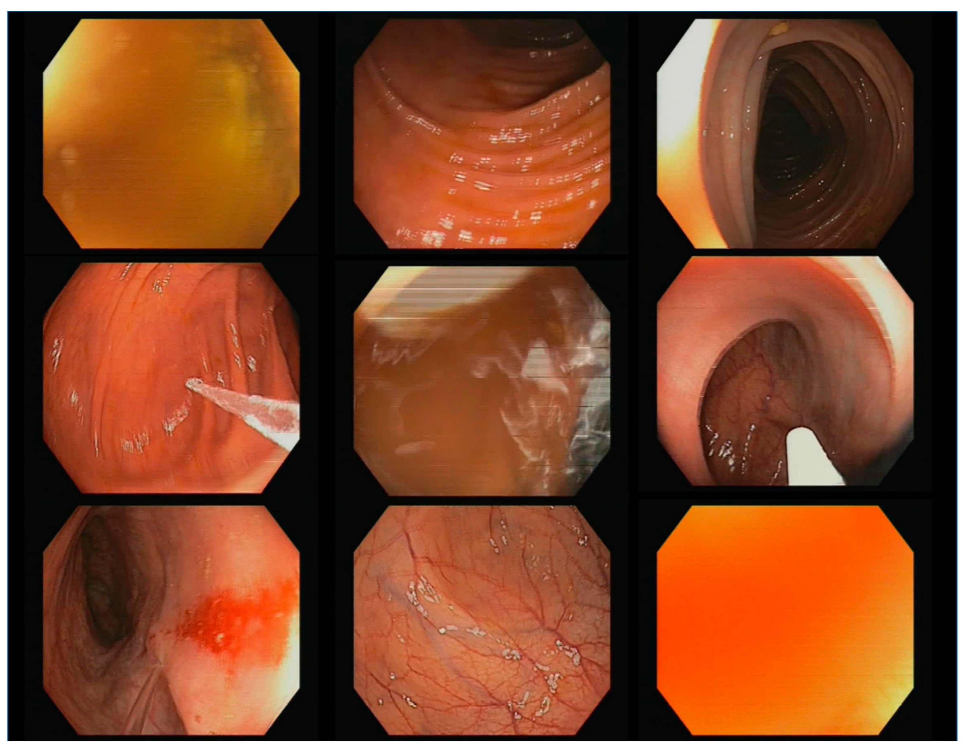 Diagnostics 13 00966 g002