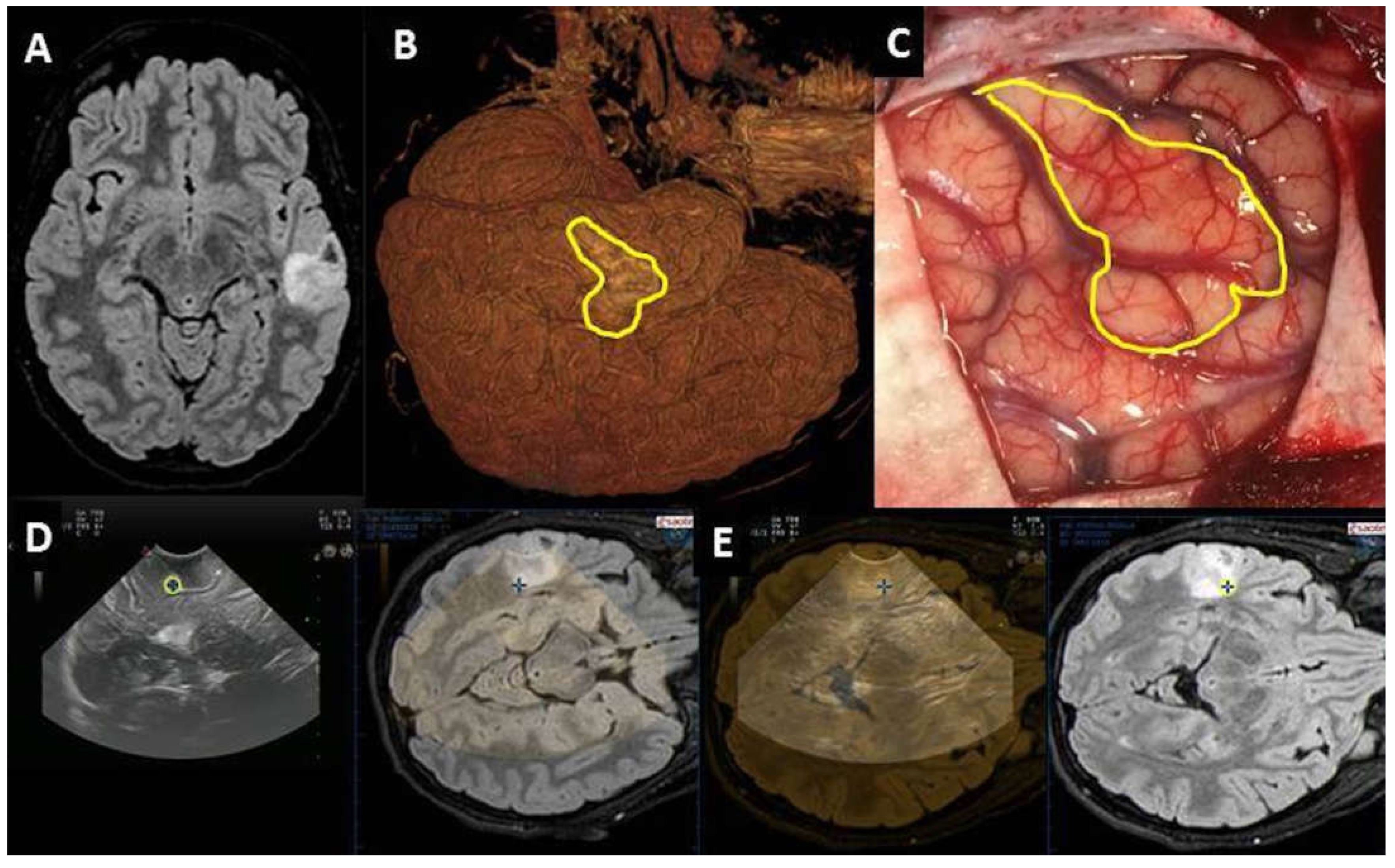 Diagnostics 13 00971 g001