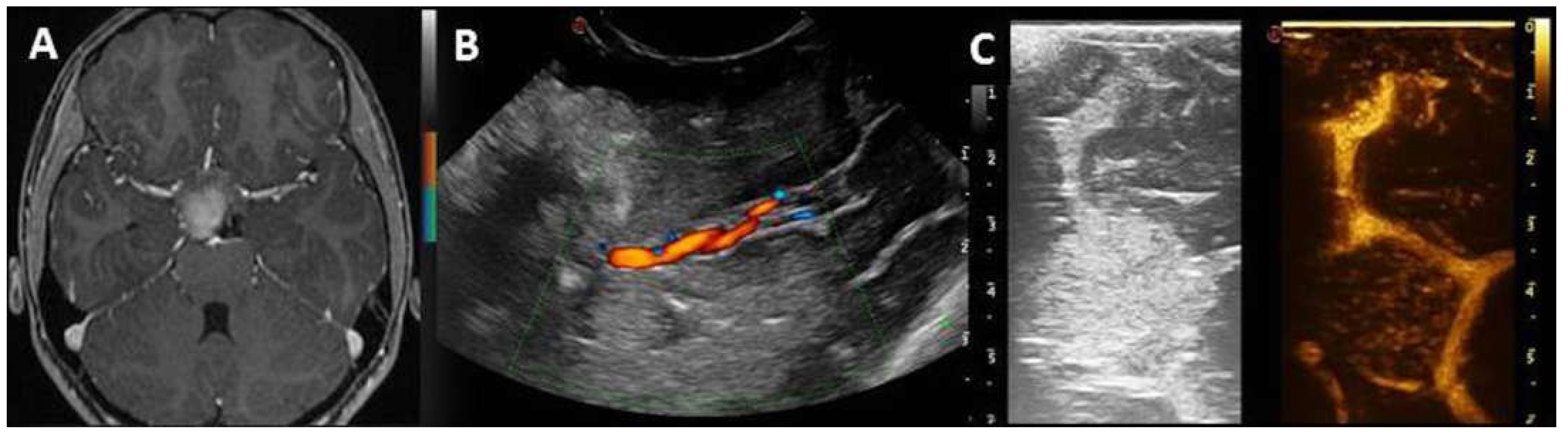 Diagnostics 13 00971 g002