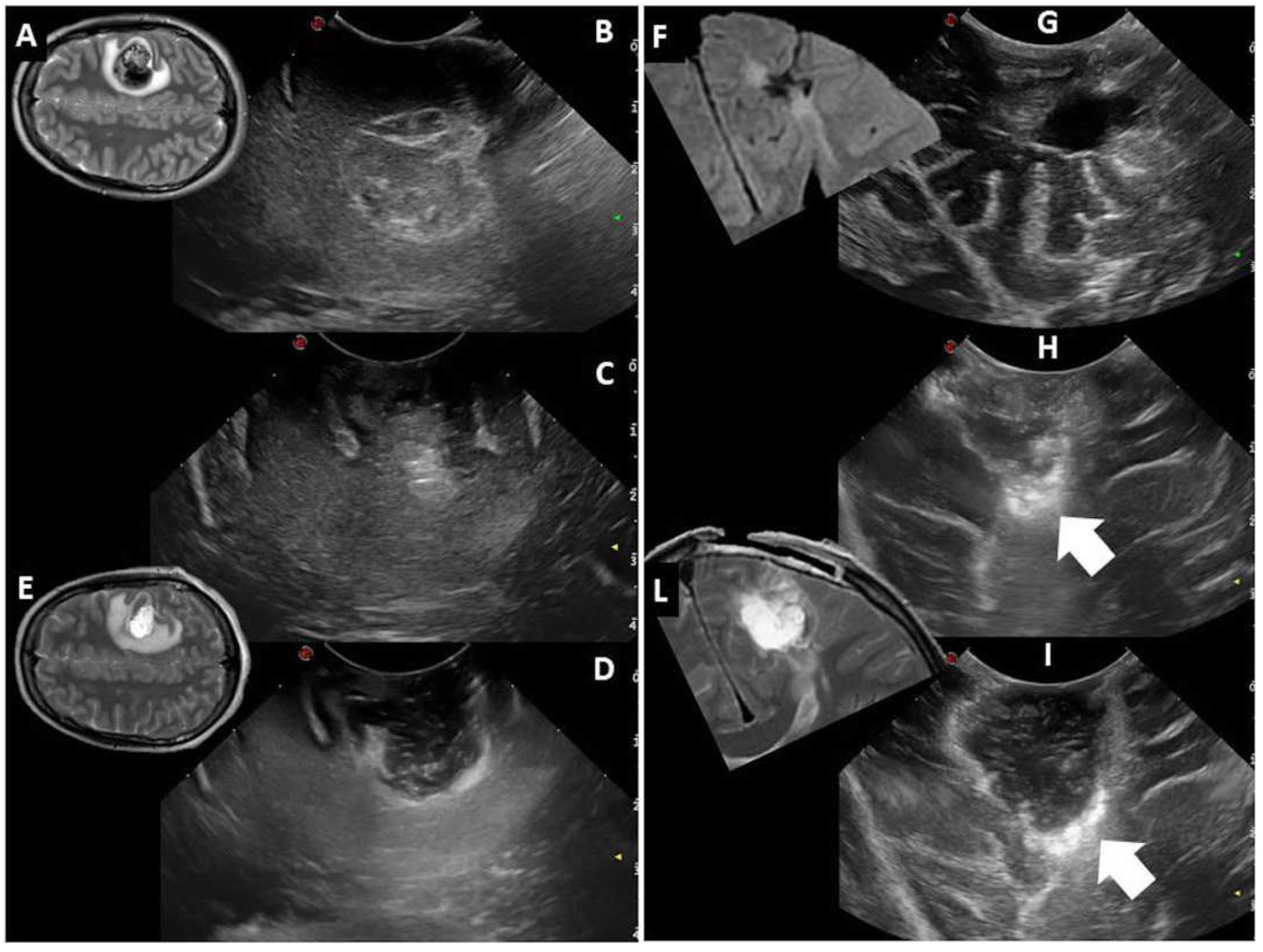 Diagnostics 13 00971 g003