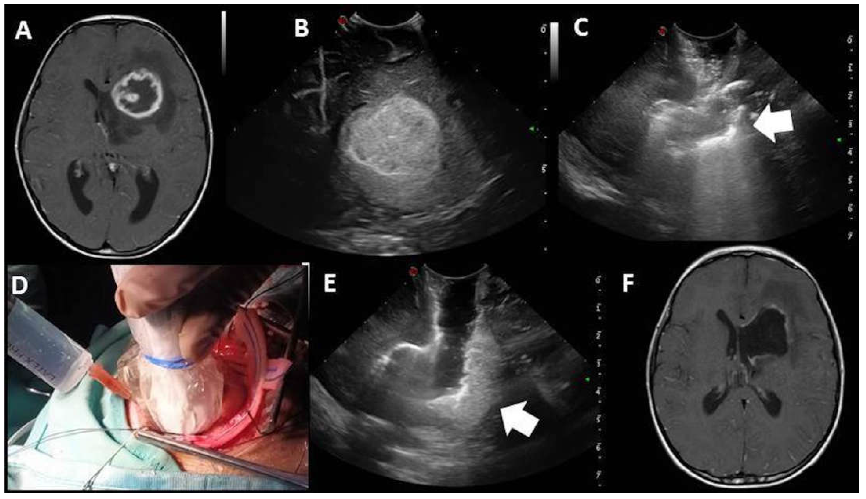 Diagnostics 13 00971 g004