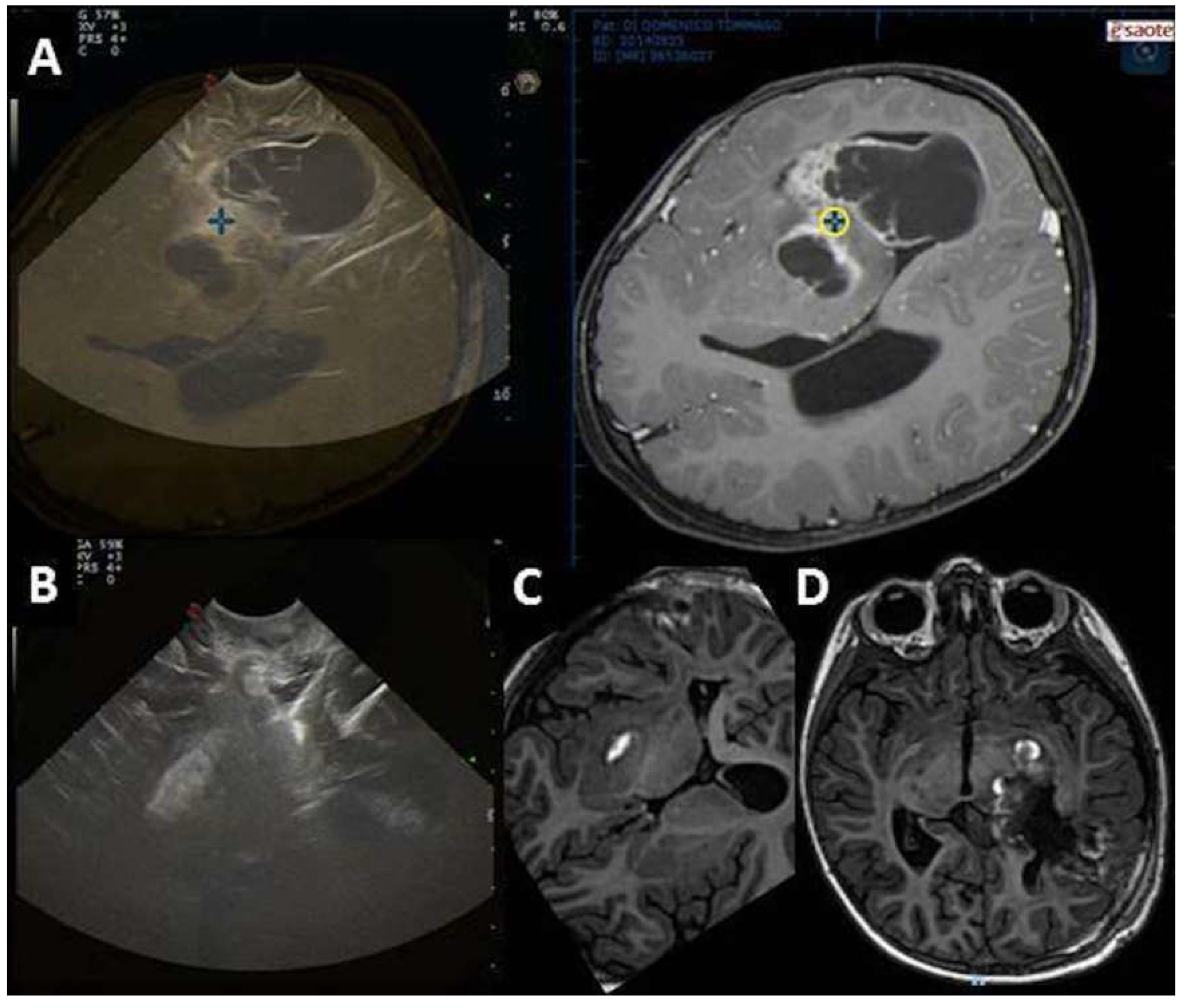 Diagnostics 13 00971 g005