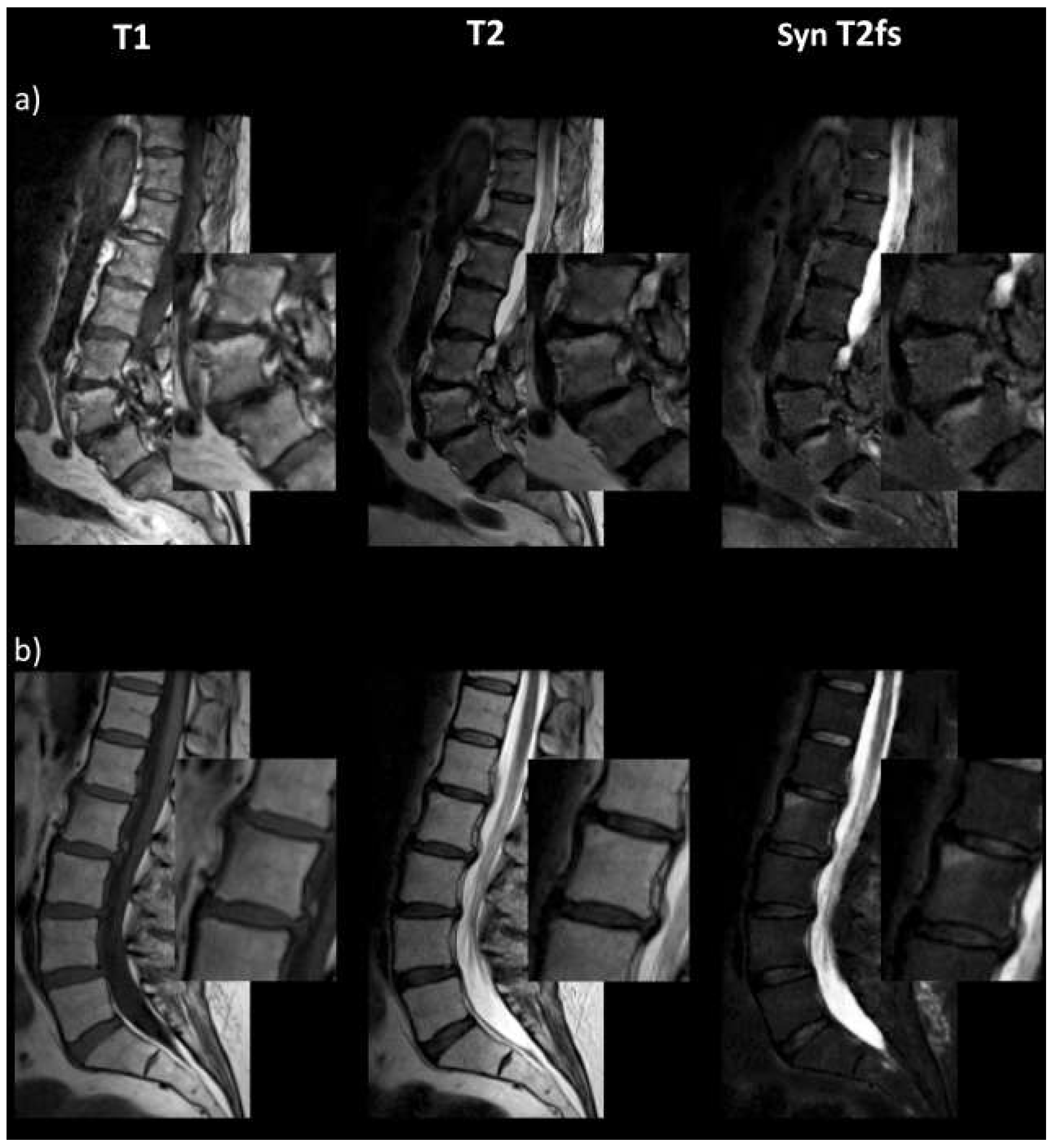 Diagnostics 13 00974 g001