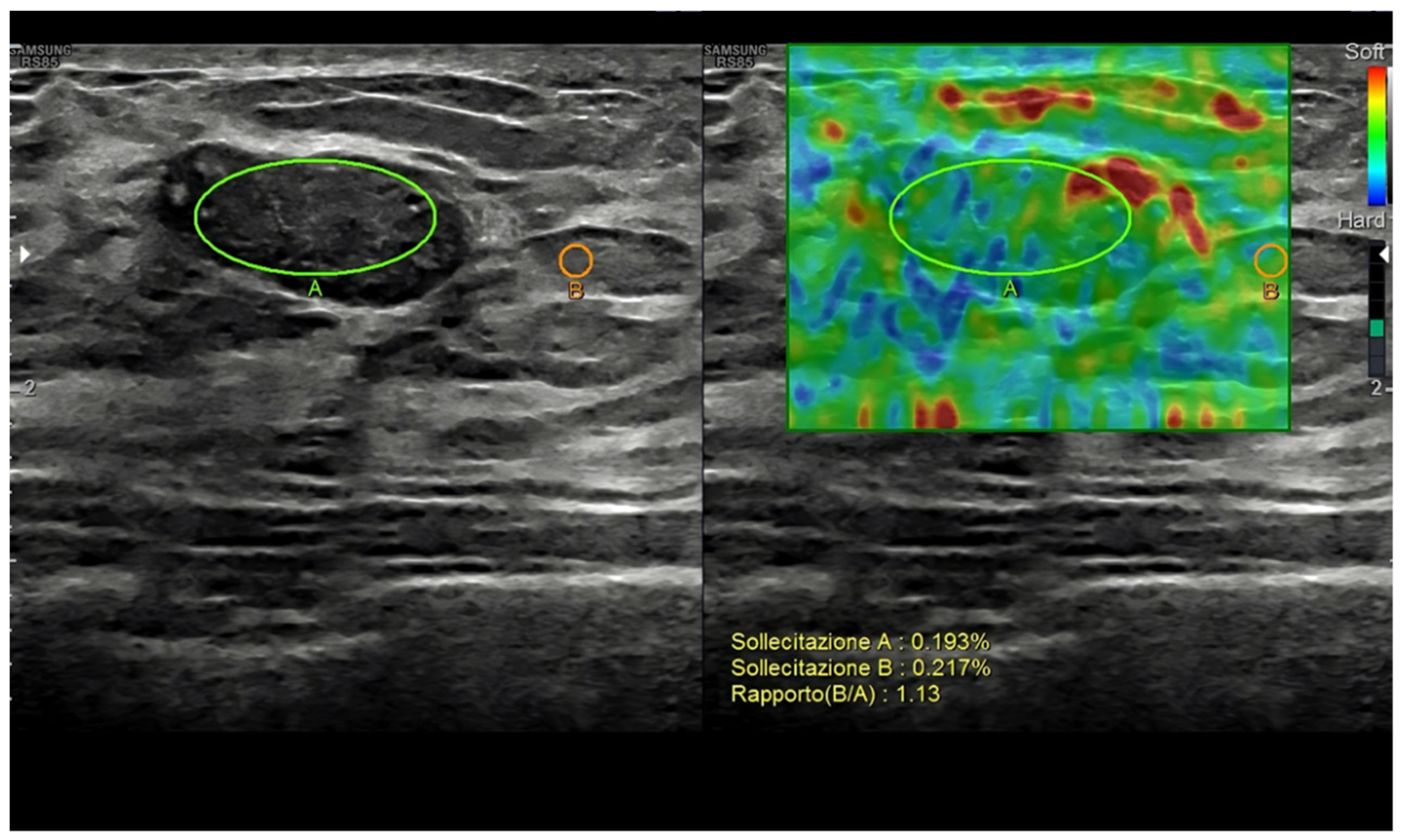 Diagnostics 13 00980 g004