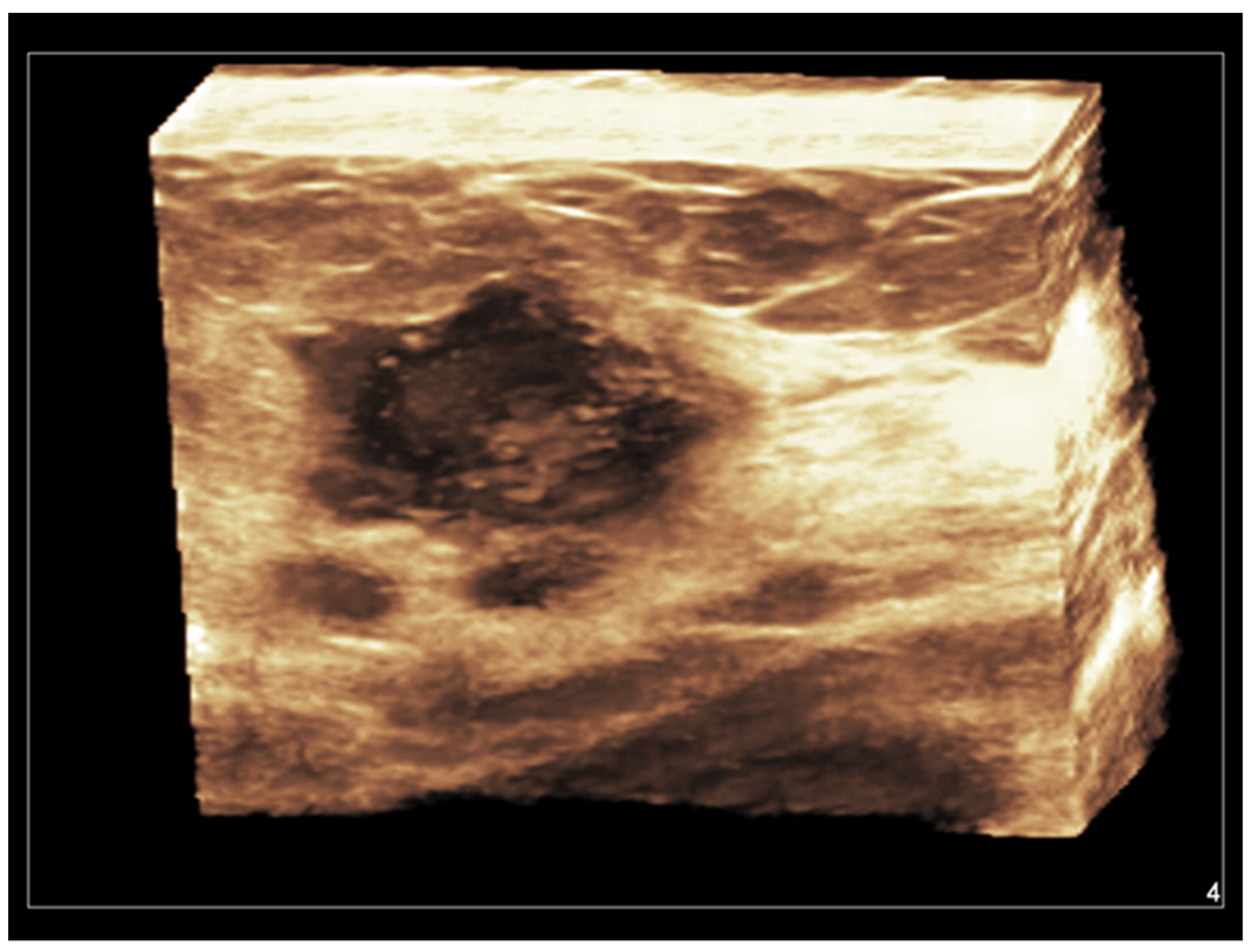 Diagnostics 13 00980 g005