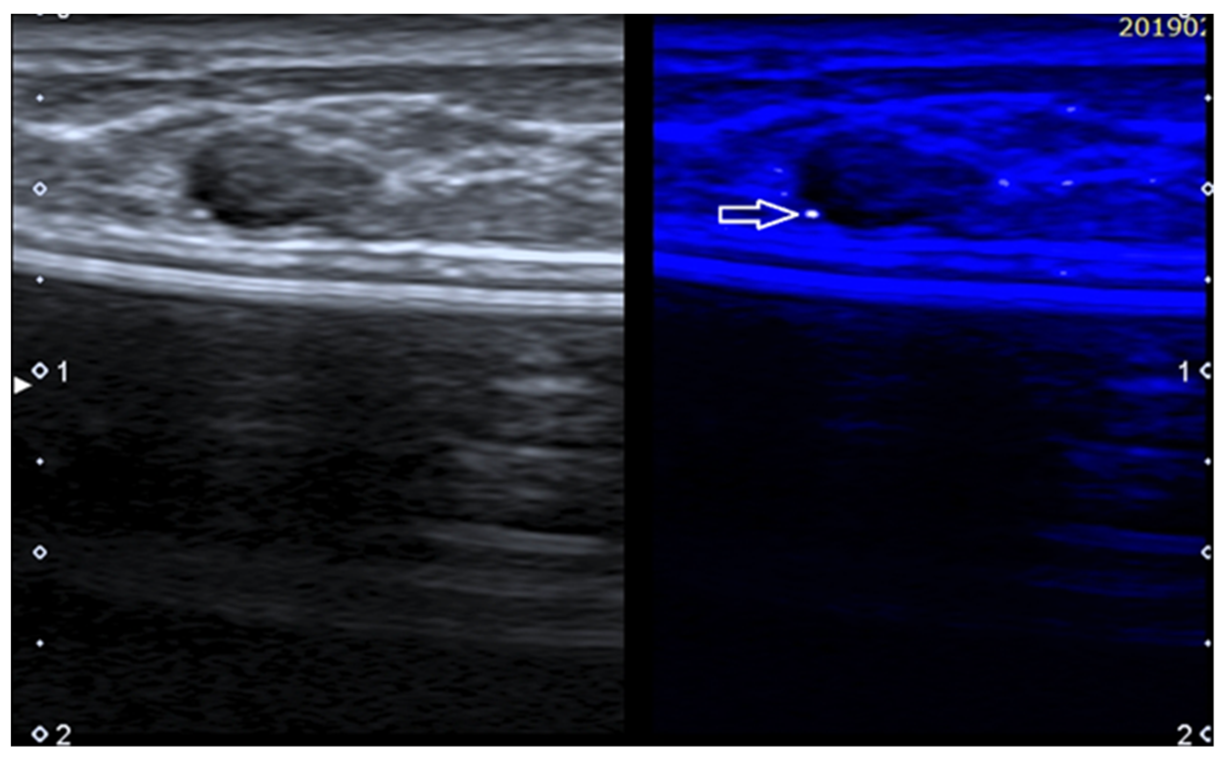 Diagnostics 13 00980 g006