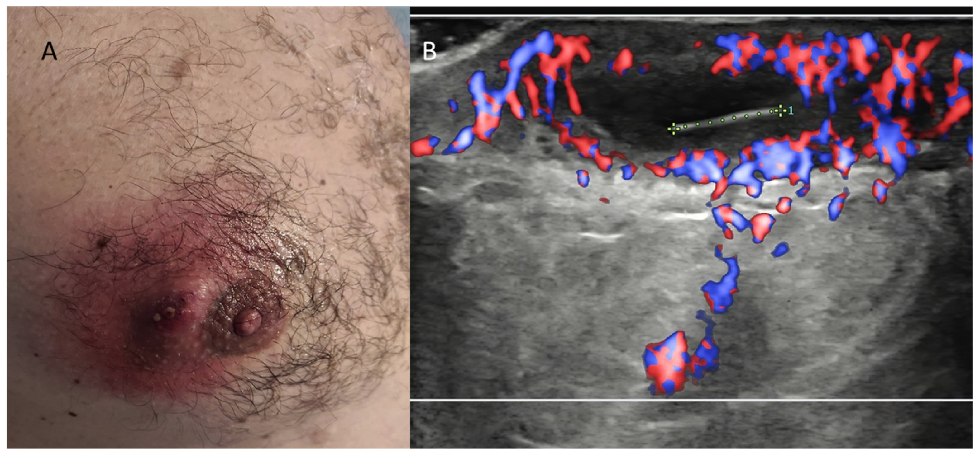 Diagnostics 13 00980 g009