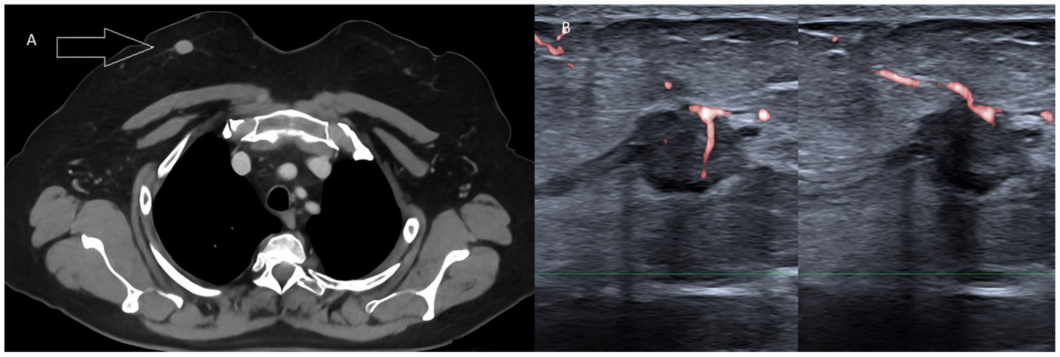 Diagnostics 13 00980 g011