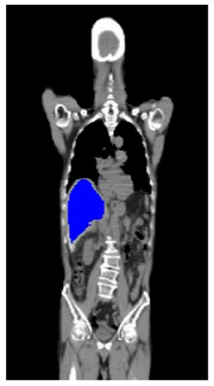 Diagnostics 13 00981 g0a2
