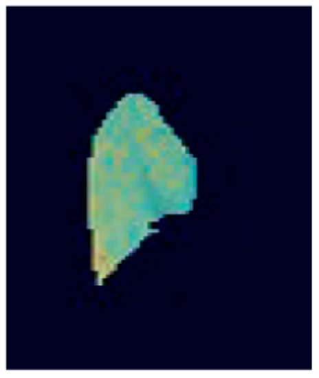 Diagnostics 13 00981 g0a3