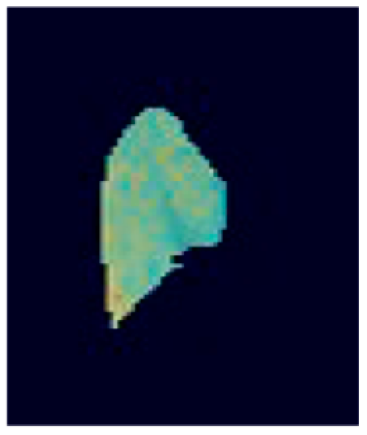 Diagnostics 13 00981 g0a3 Diagnostics 13 00981 g0a3