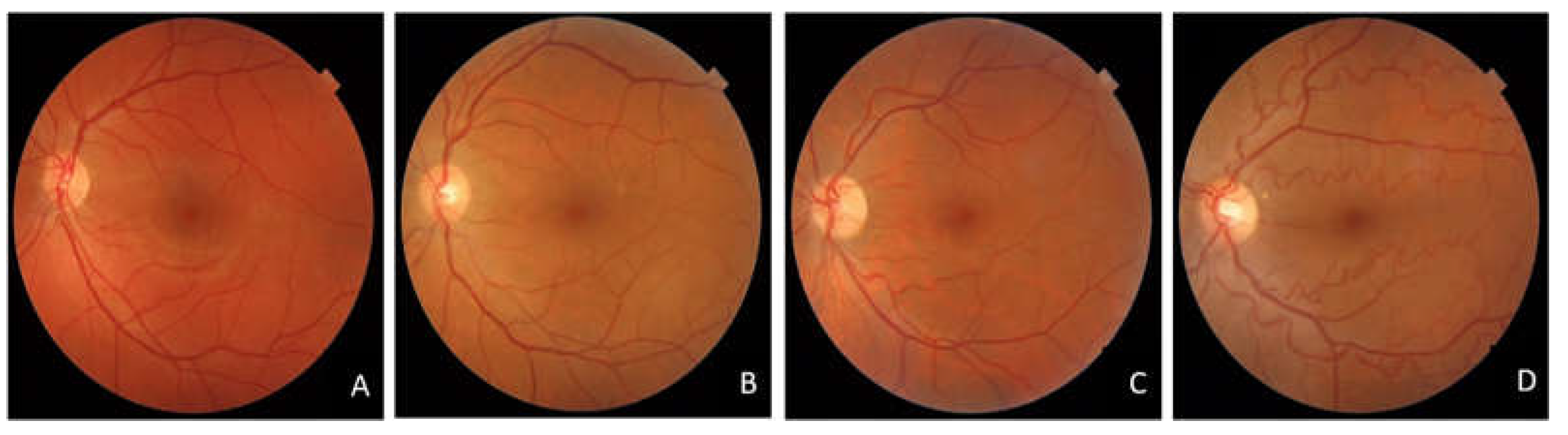 Diagnostics 13 00982 g002 Diagnostics 13 00982 g002