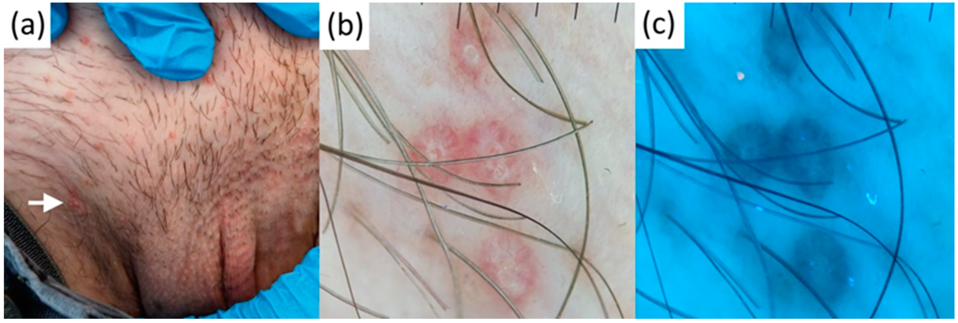 Diagnostics 13 00985 g004