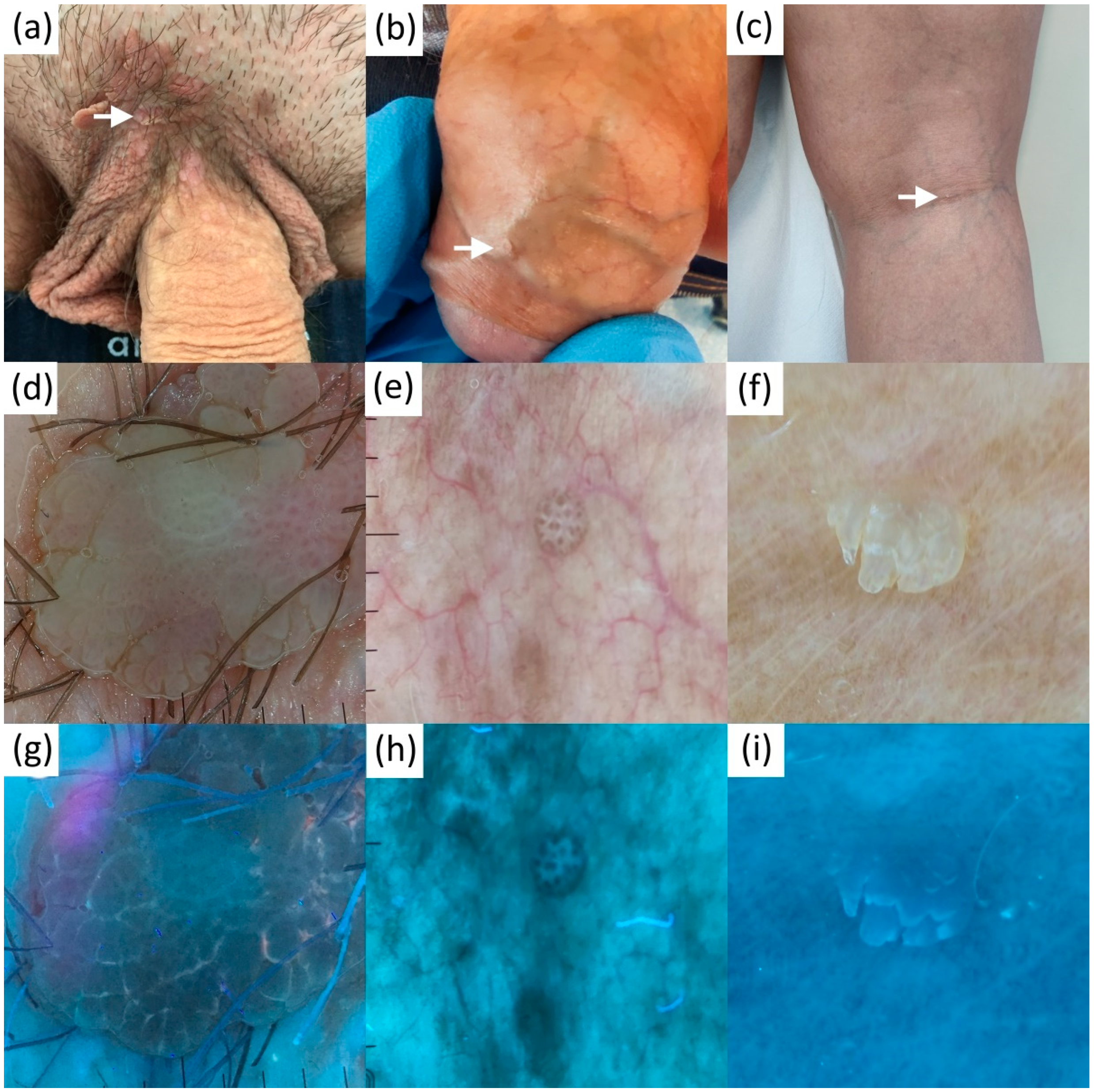 Diagnostics 13 00985 g005