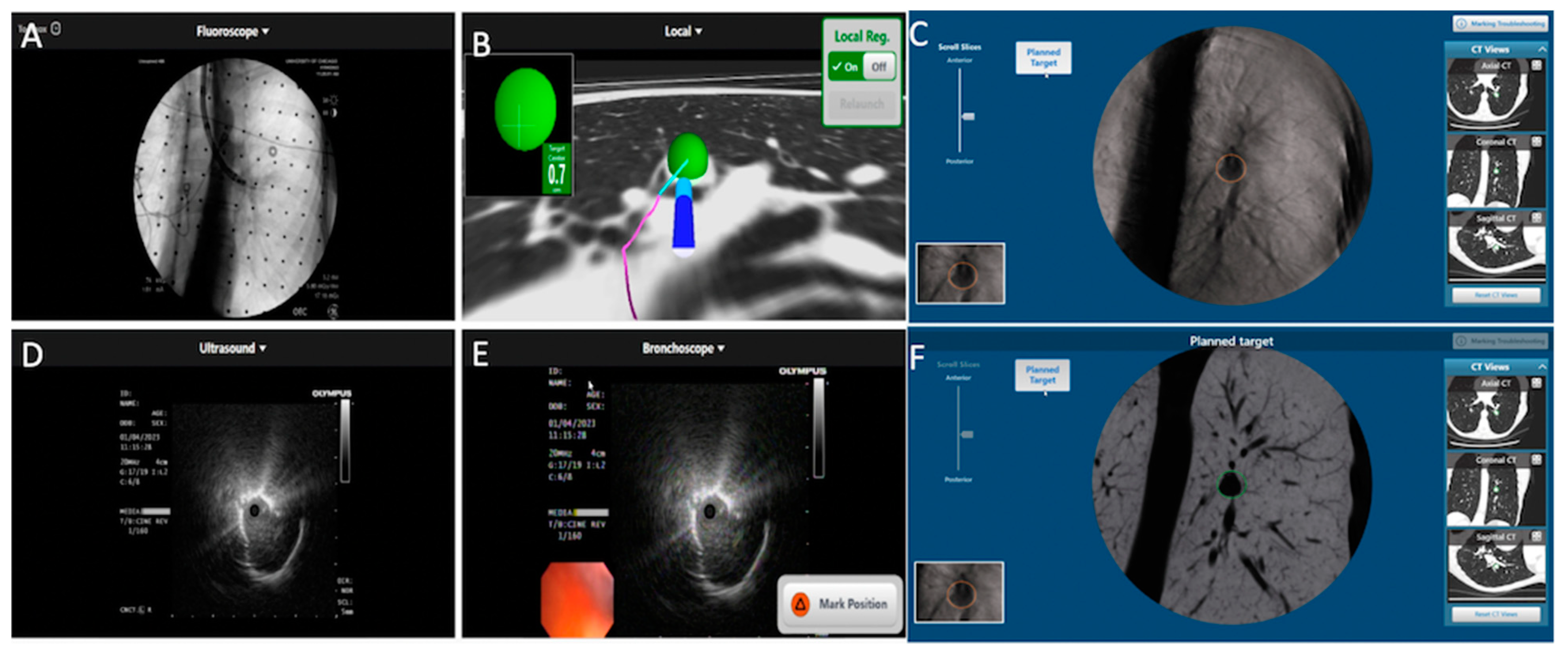 Diagnostics 13 00990 g003