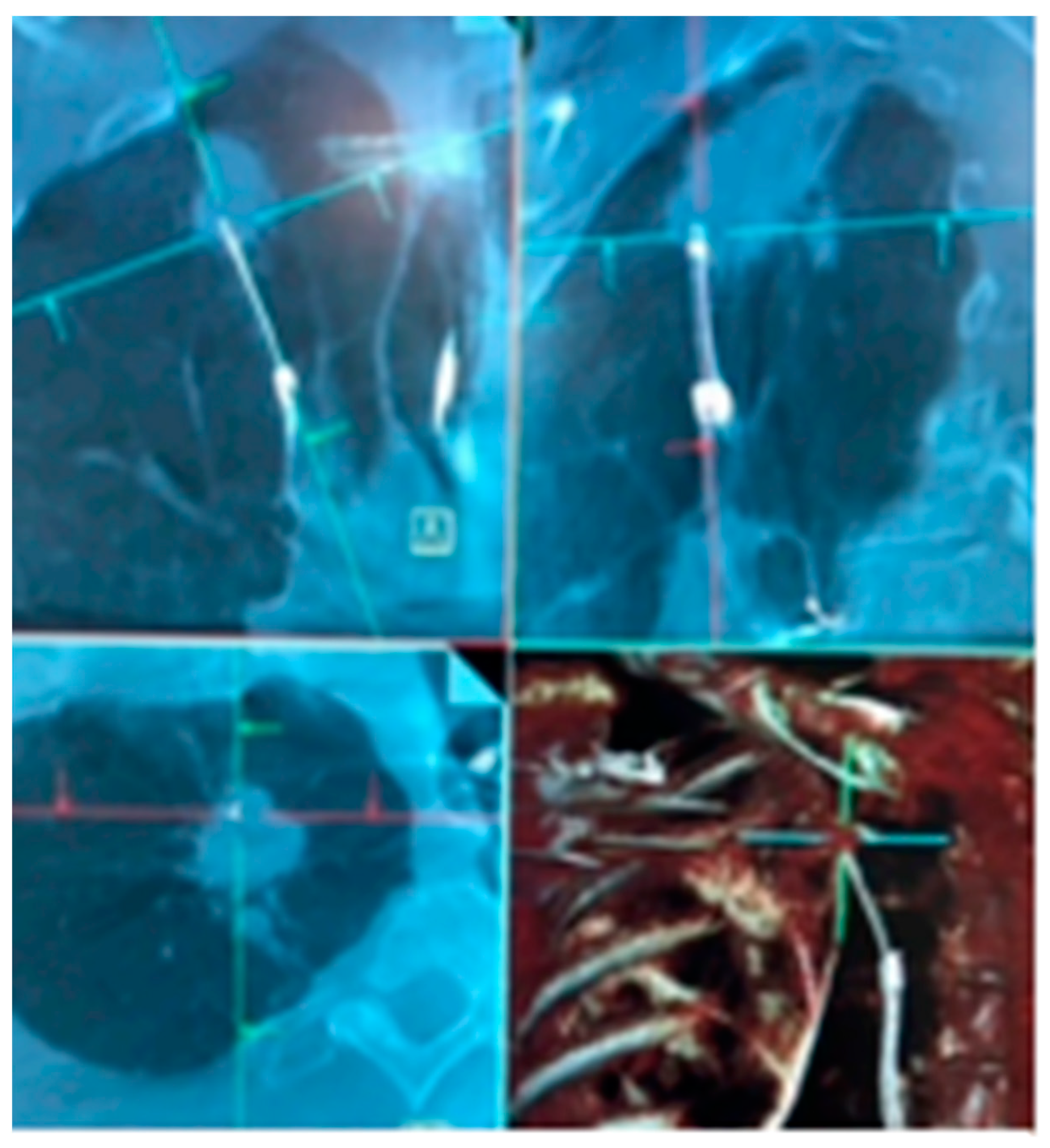 Diagnostics 13 00990 g005