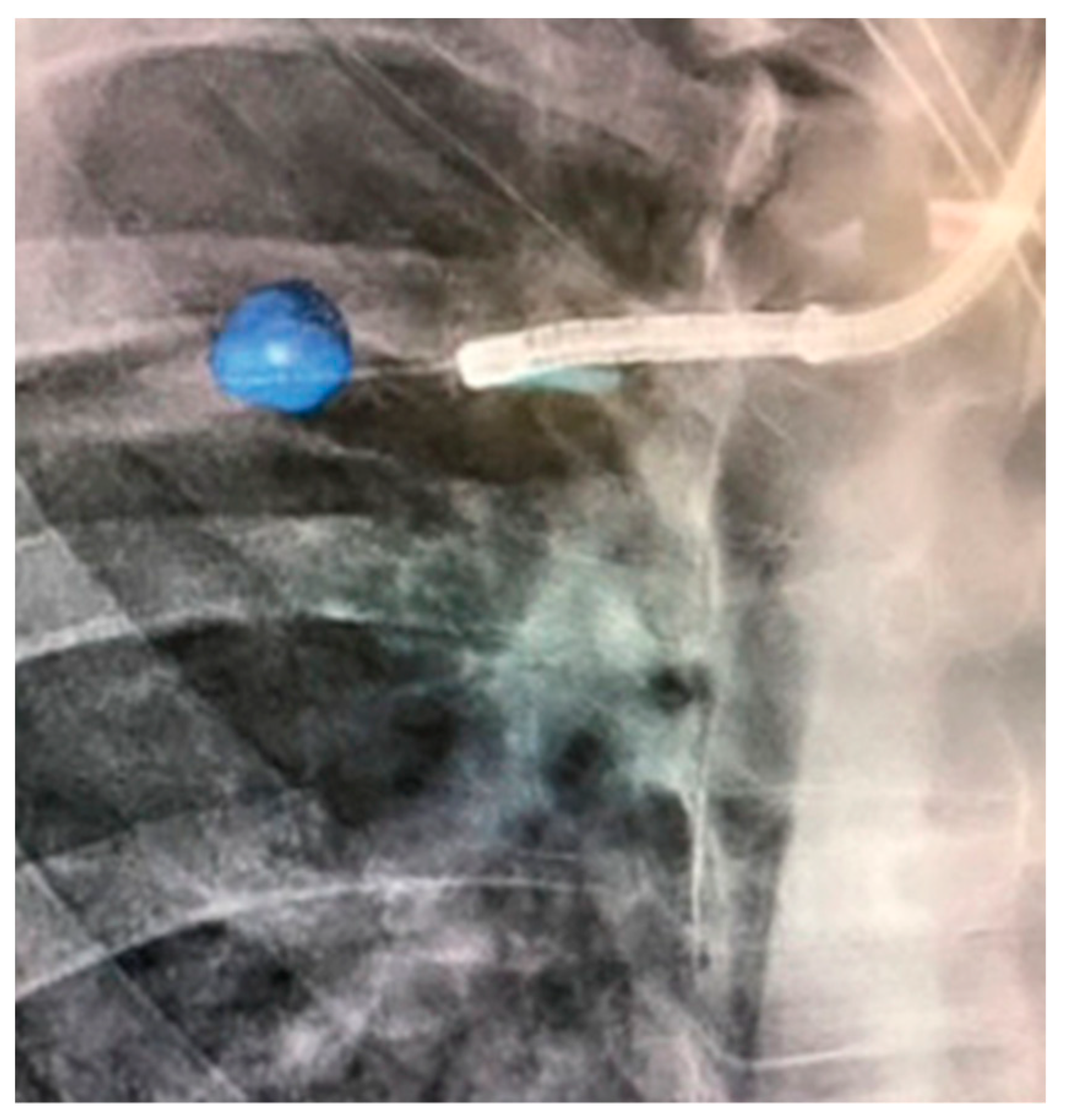 Diagnostics 13 00990 g006