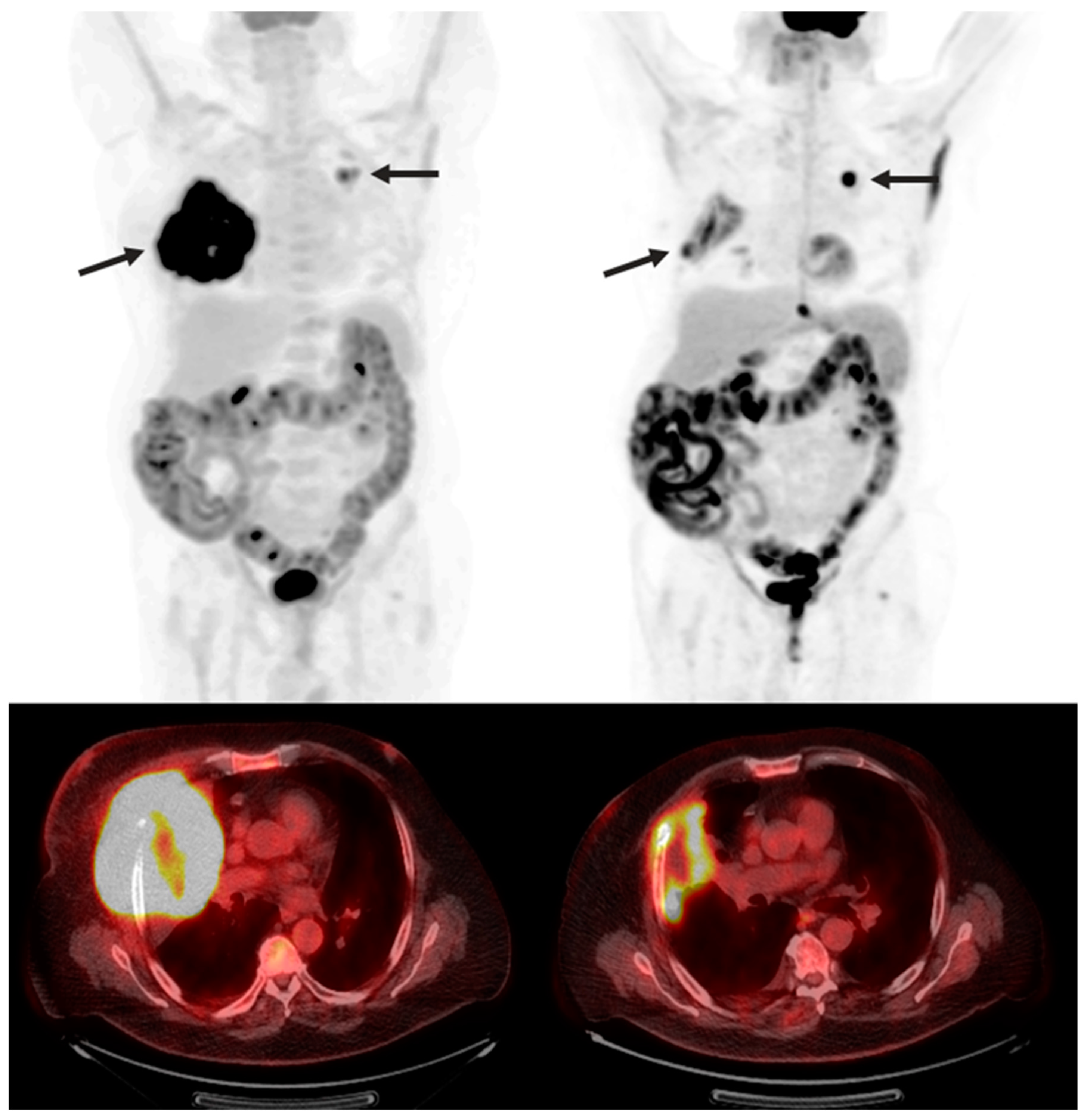 Diagnostics 13 00992 g004