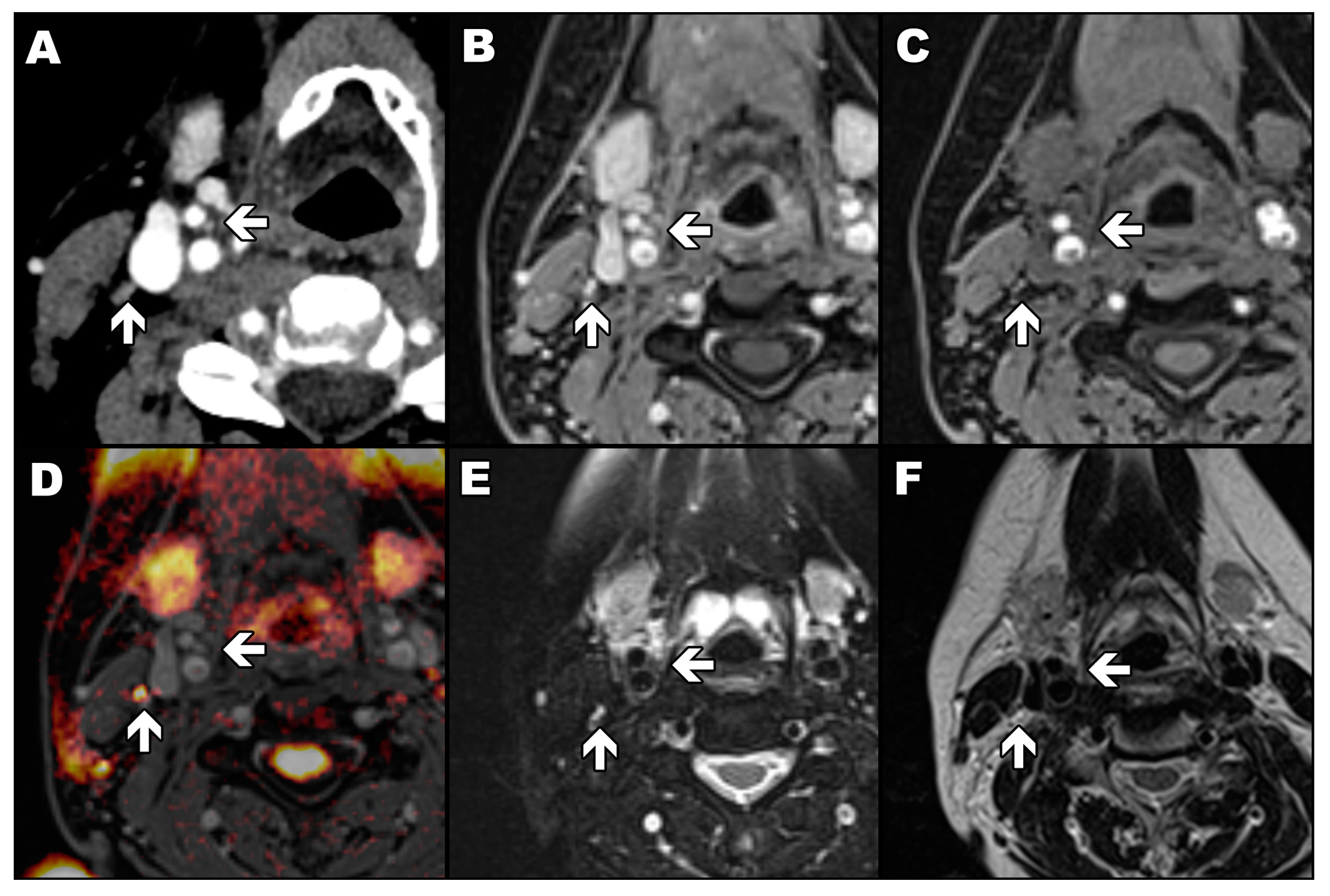 Diagnostics 13 00993 g001