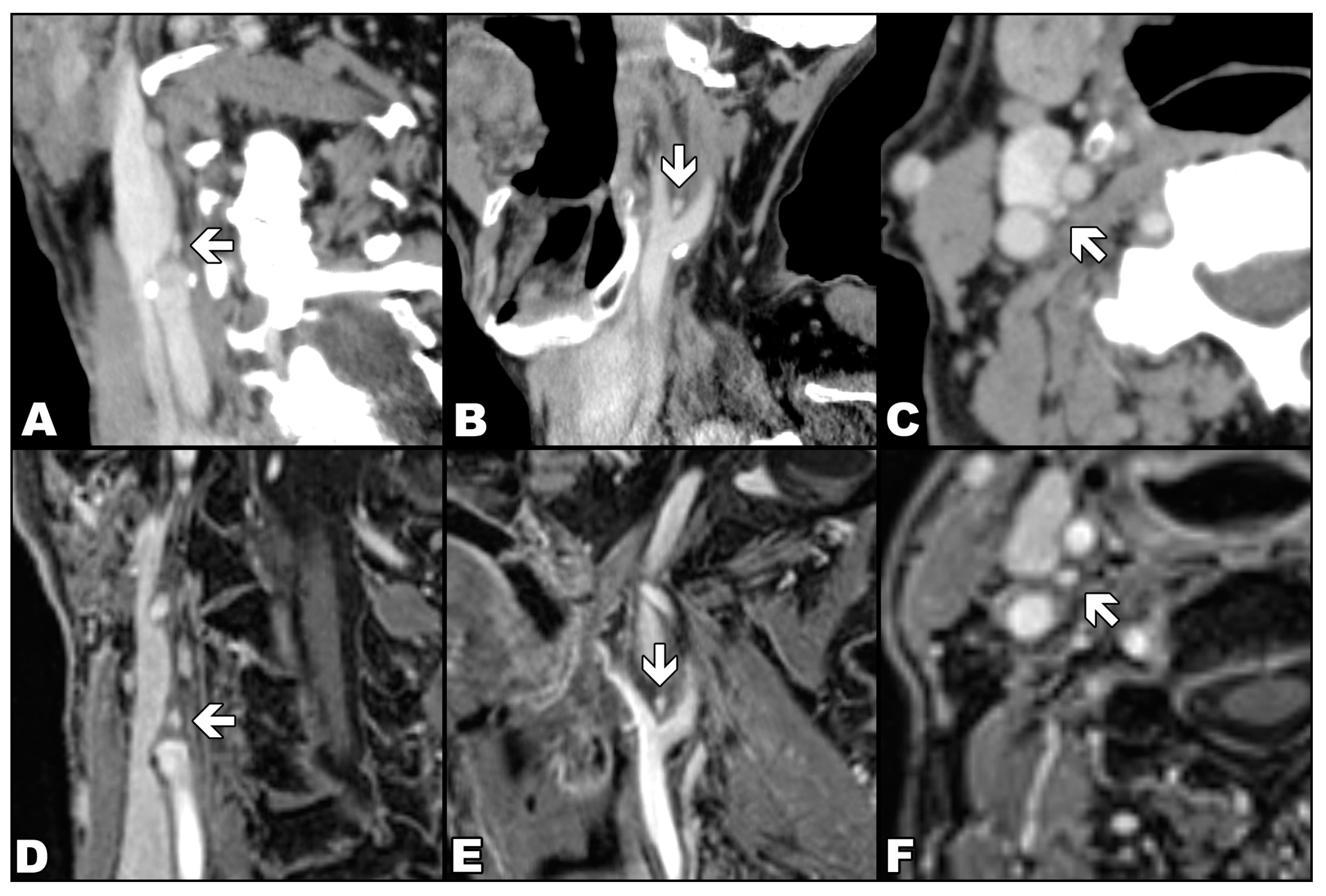 Diagnostics 13 00993 g002
