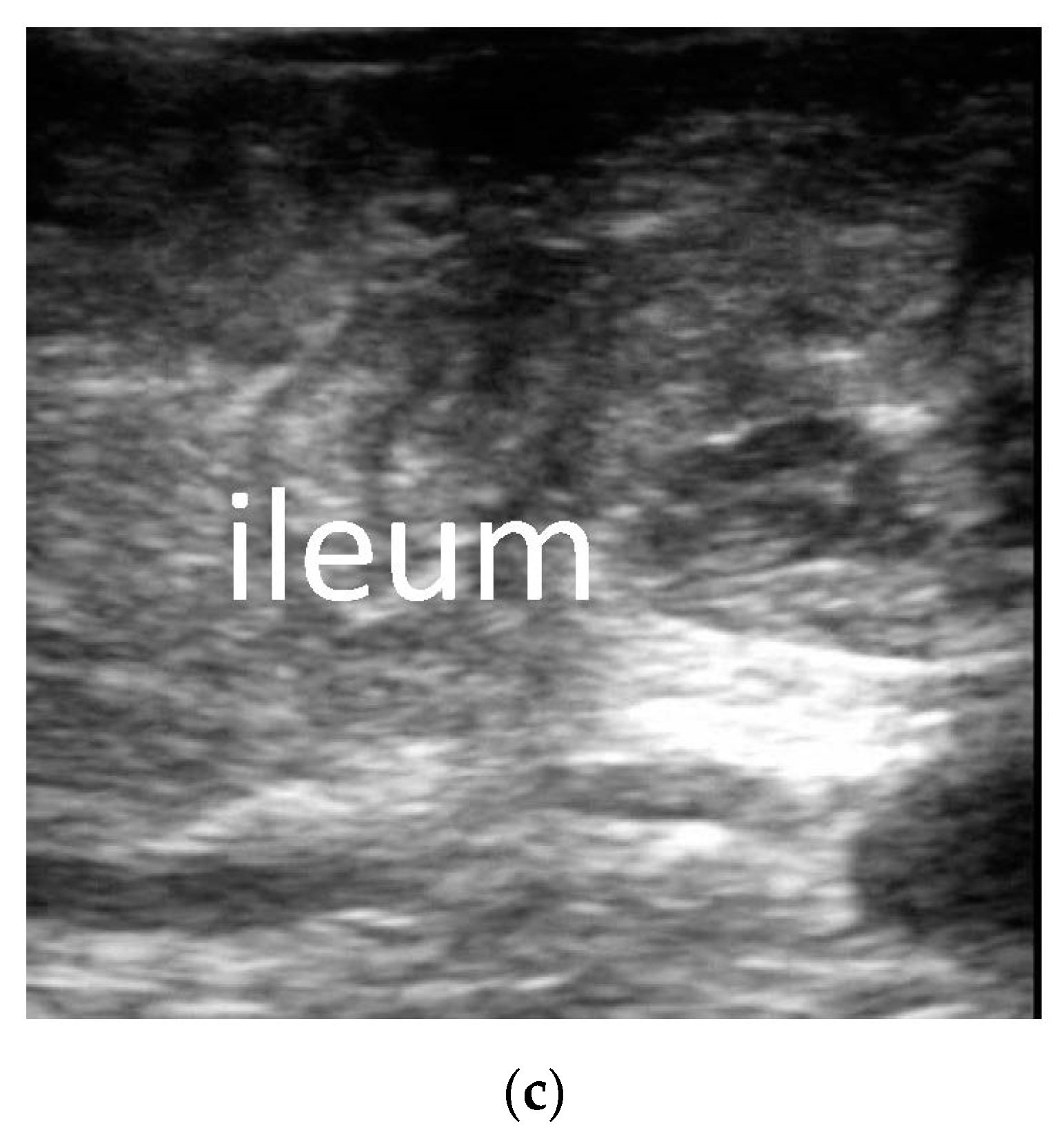 Diagnostics 13 00995 g003b